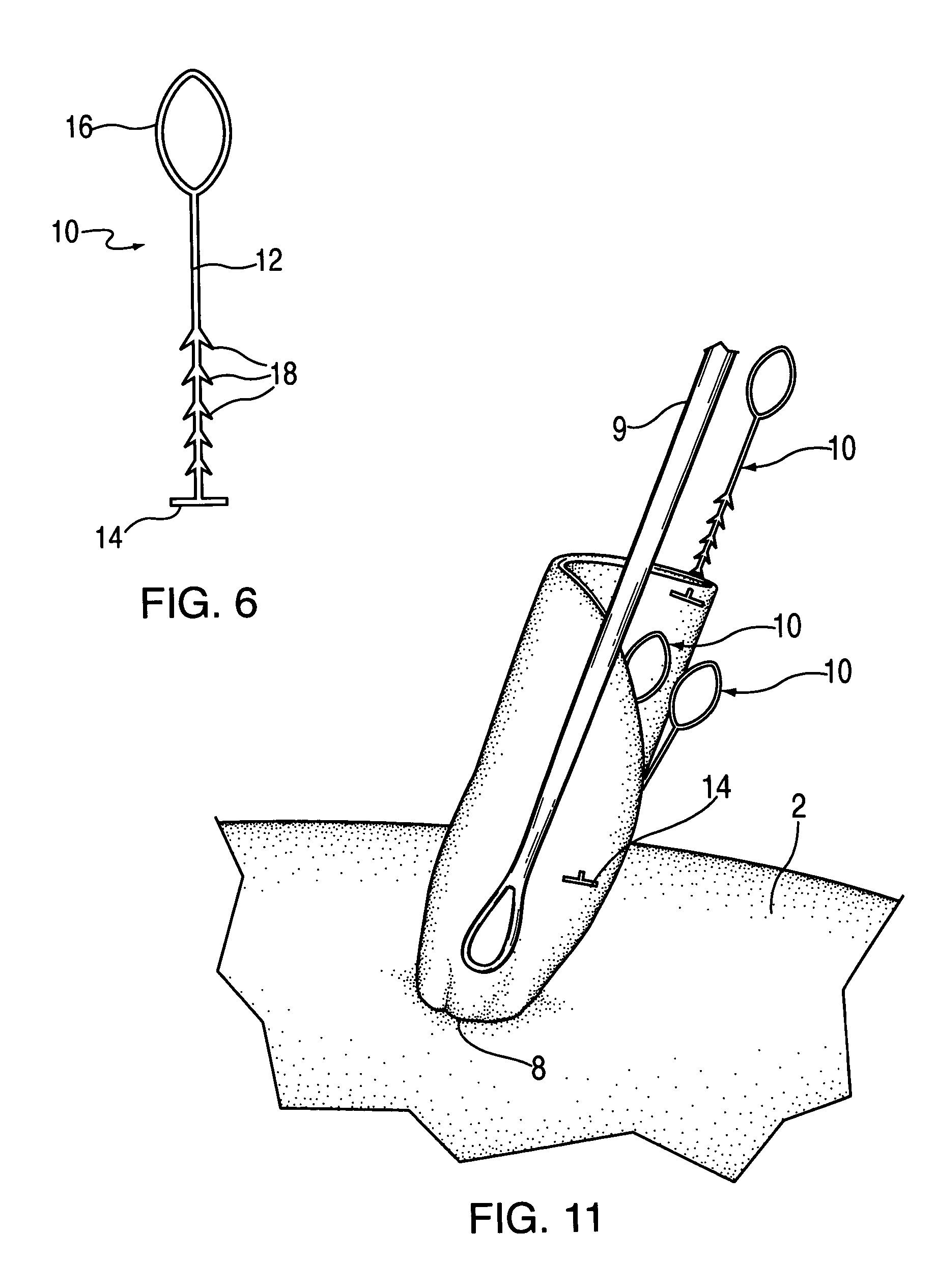 Device and method for tacking a prosthetic screen