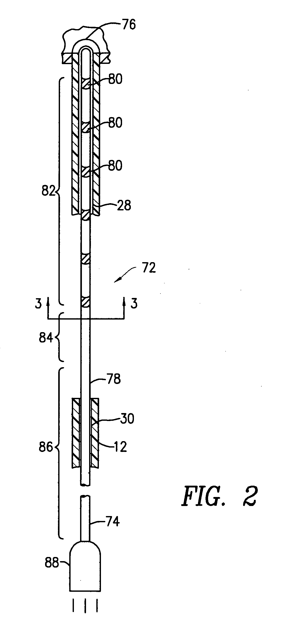 Miniature circular mapping catheter