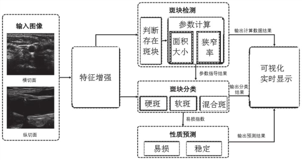 Carotid artery ultrasound image plaque classification detection method and system