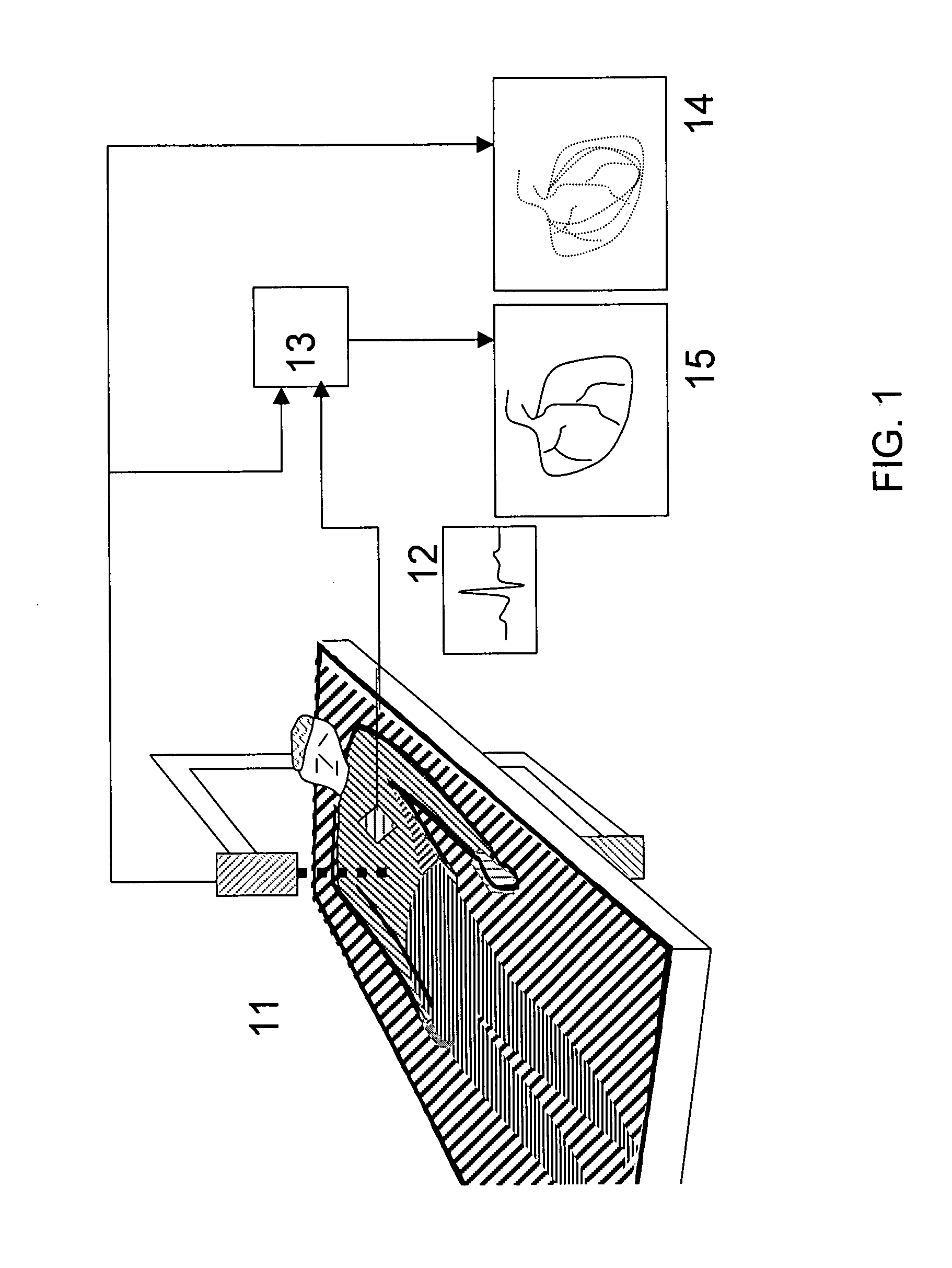 Tools for use with moving organs