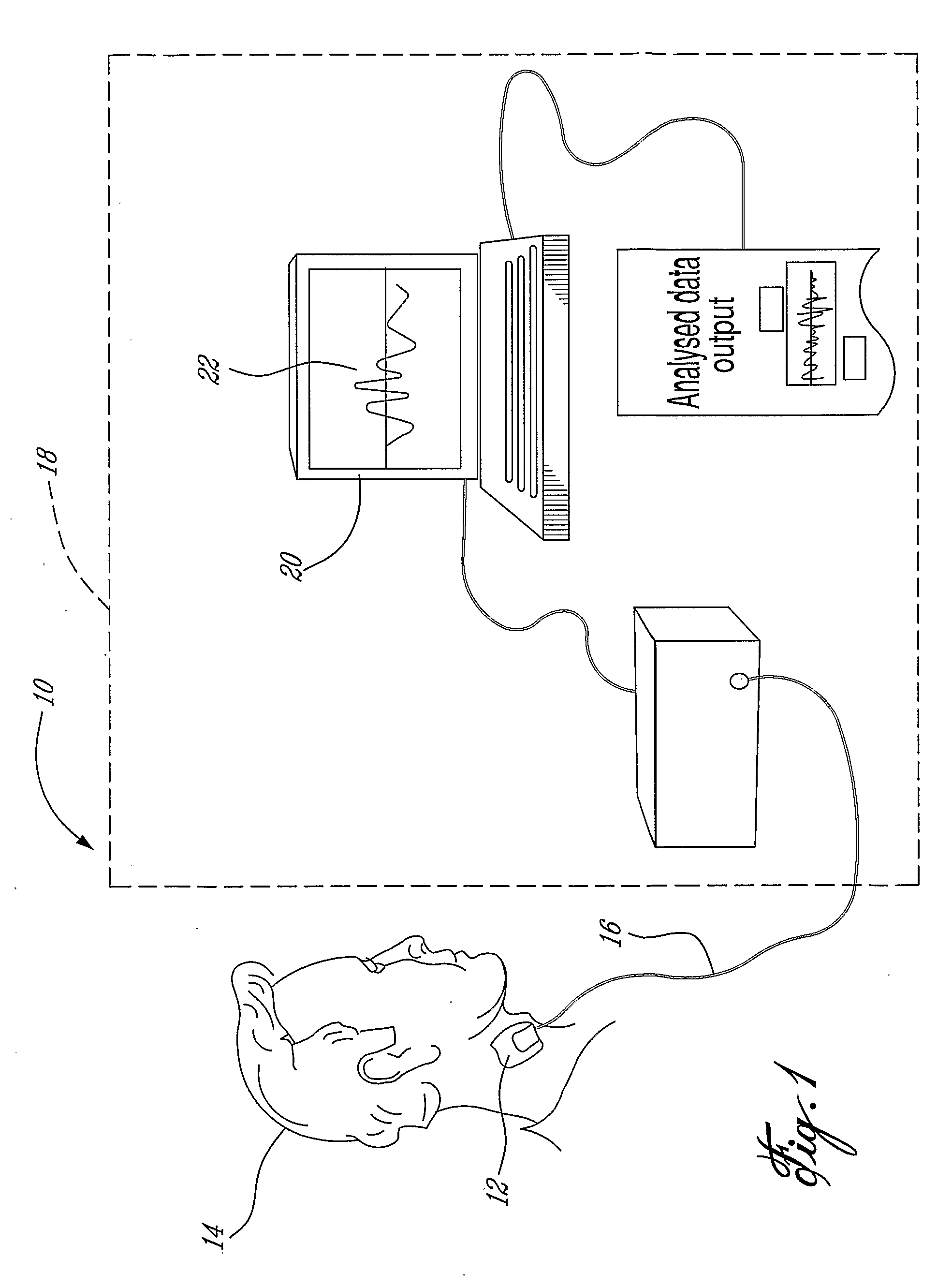 Non-Invasive Monitoring of Respiratory Rate, Heart Rate and Apnea