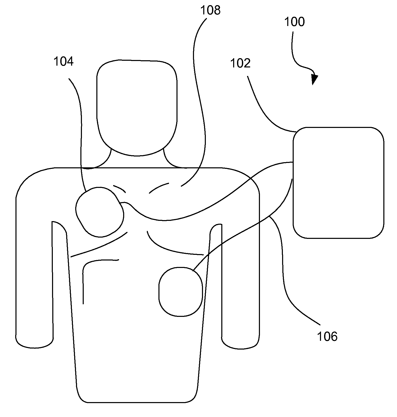 External defibrillator