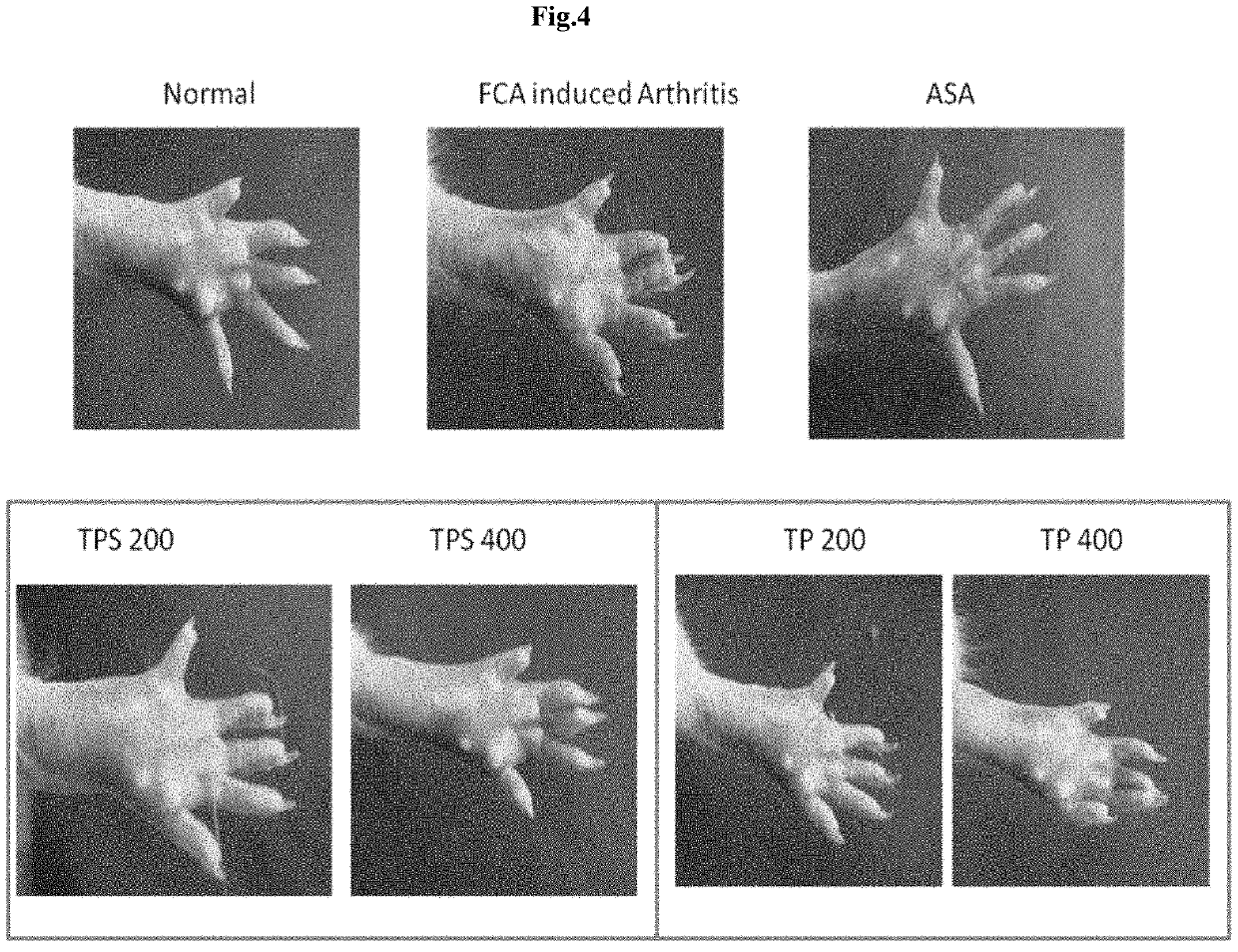 Isolates from spent turmeric for the management of rheumatoid arthritis