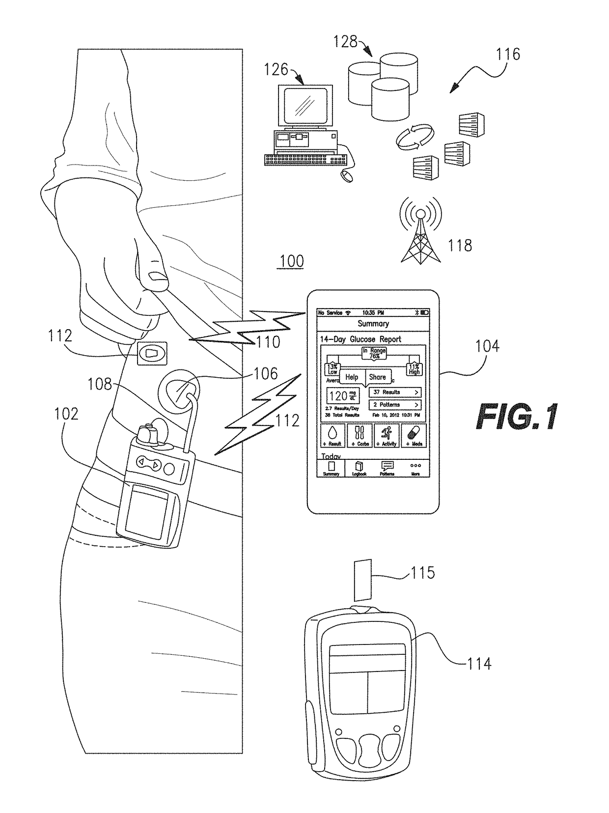 Method and system for closed-loop control of an artificial pancreas