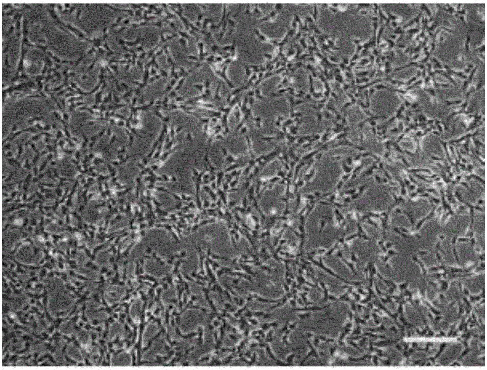 Method for preparing mesenchymal stem cell by fully utilizing umbilical cord resources