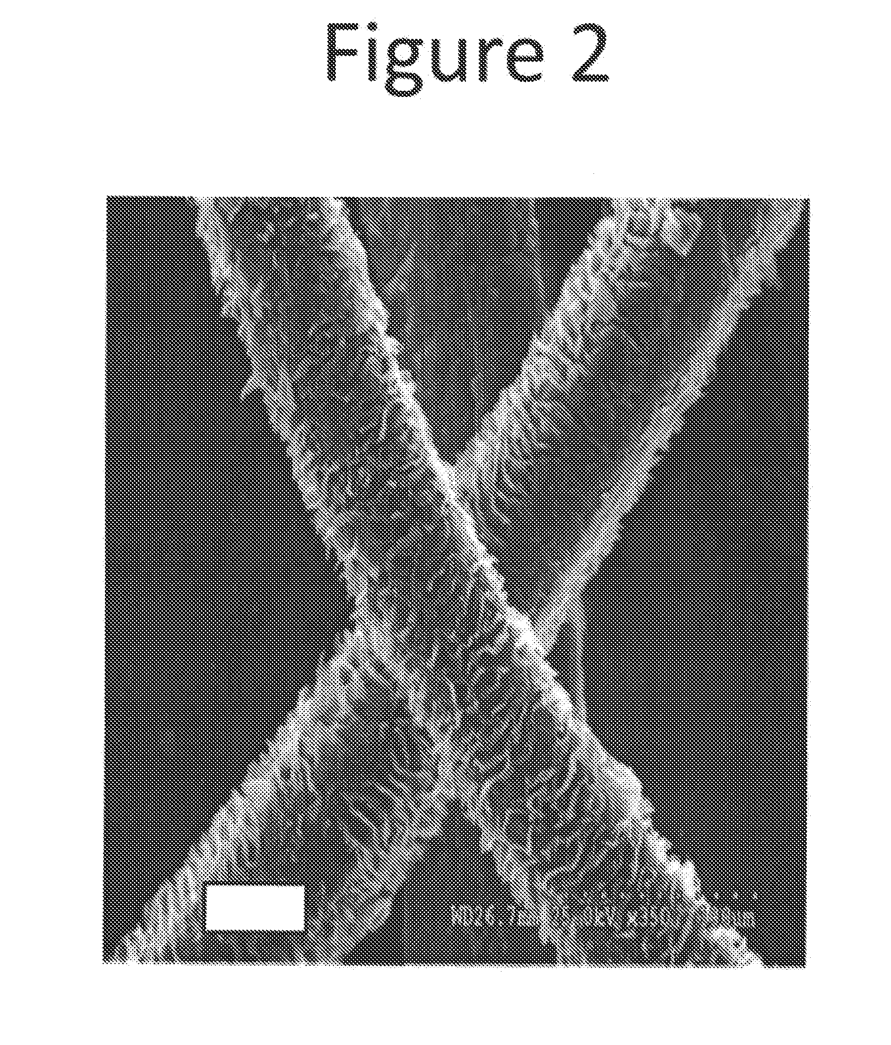 Methods for extracting keratin proteins