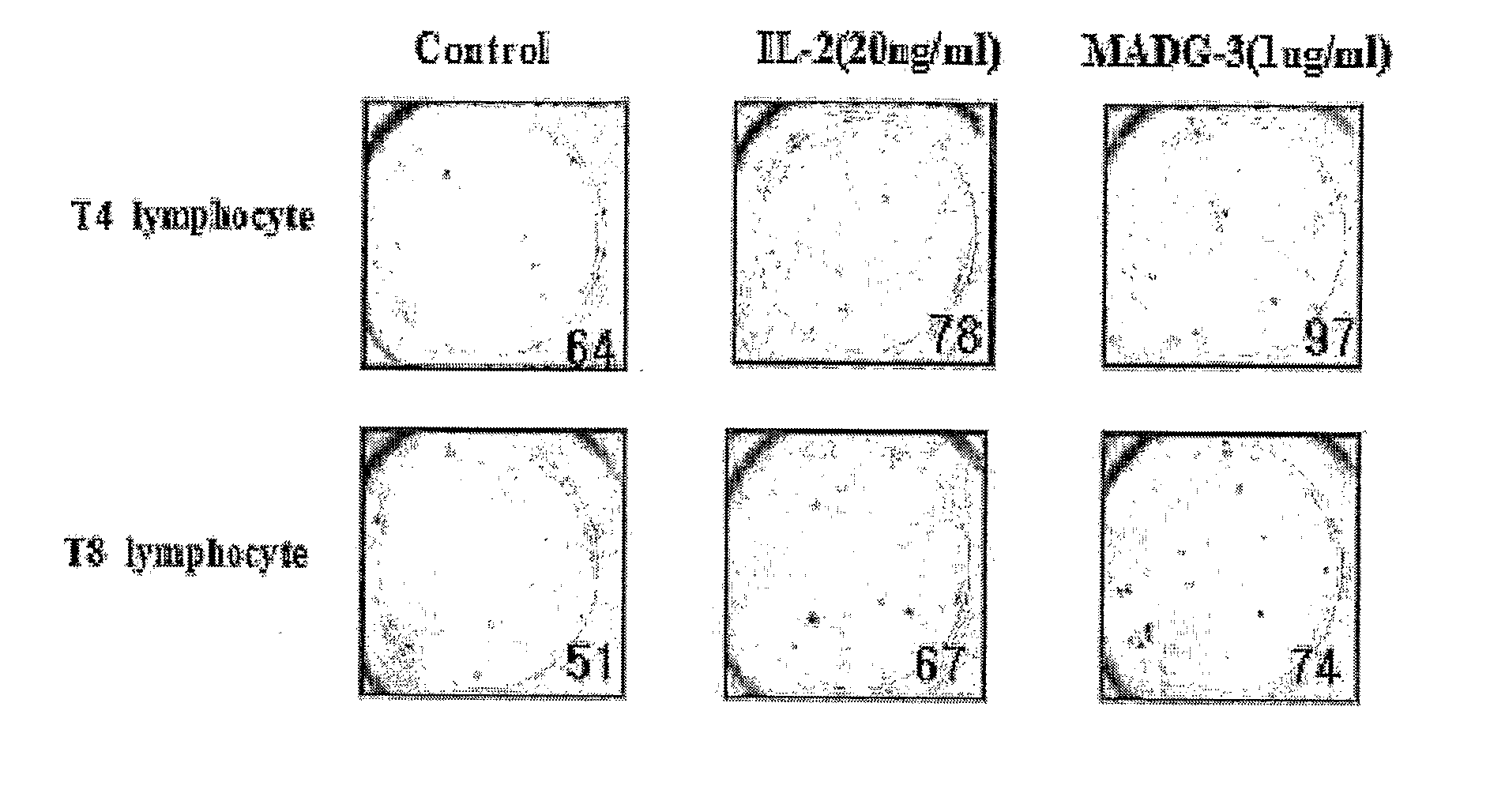 Immunomodulating Agent, Anti-Cancer Agent and Health Food Containing Monoacetyldiacylglycerol Derivatives