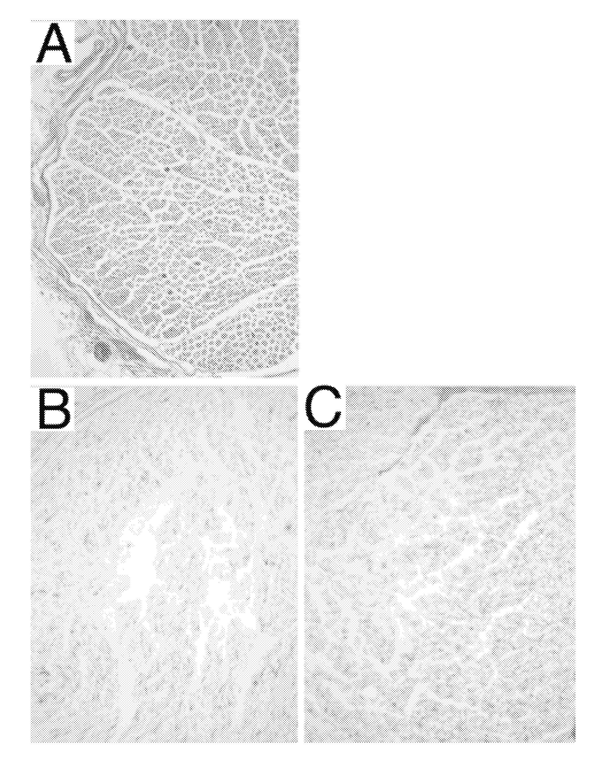 Method for decellularization of tissue grafts