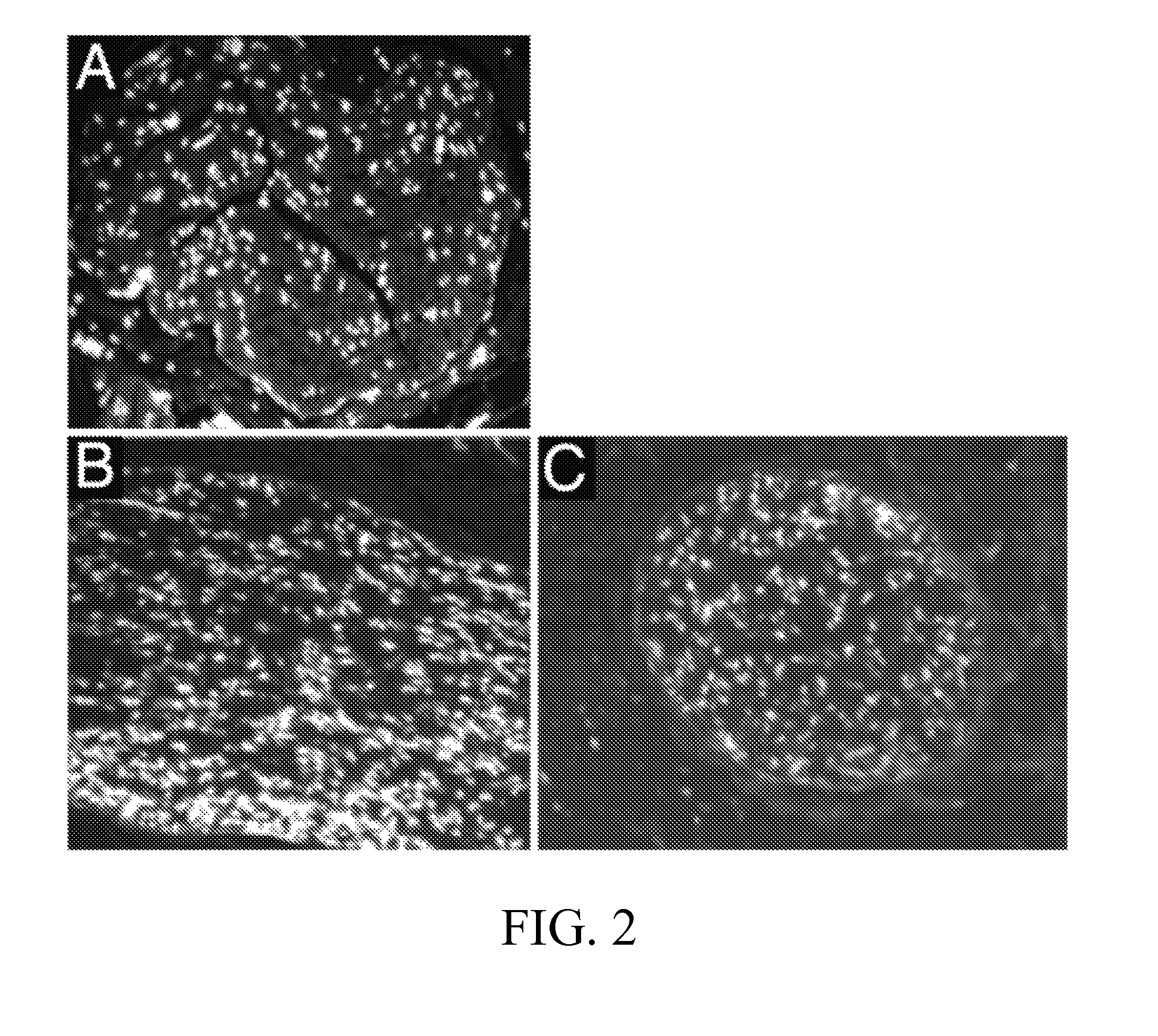 Method for decellularization of tissue grafts