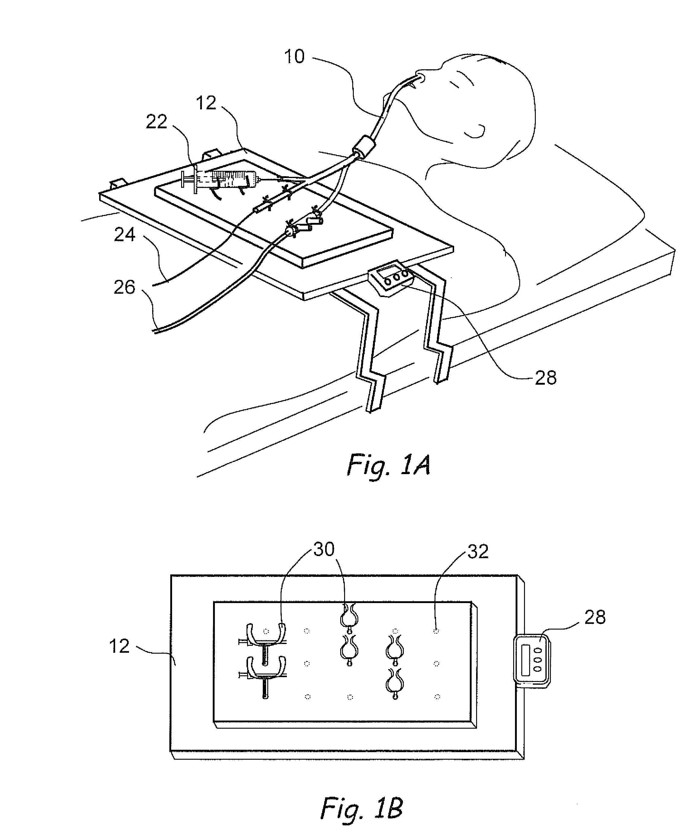 Devices, Systems and Methods for Treating Disorders of the Ear, Nose and Throat