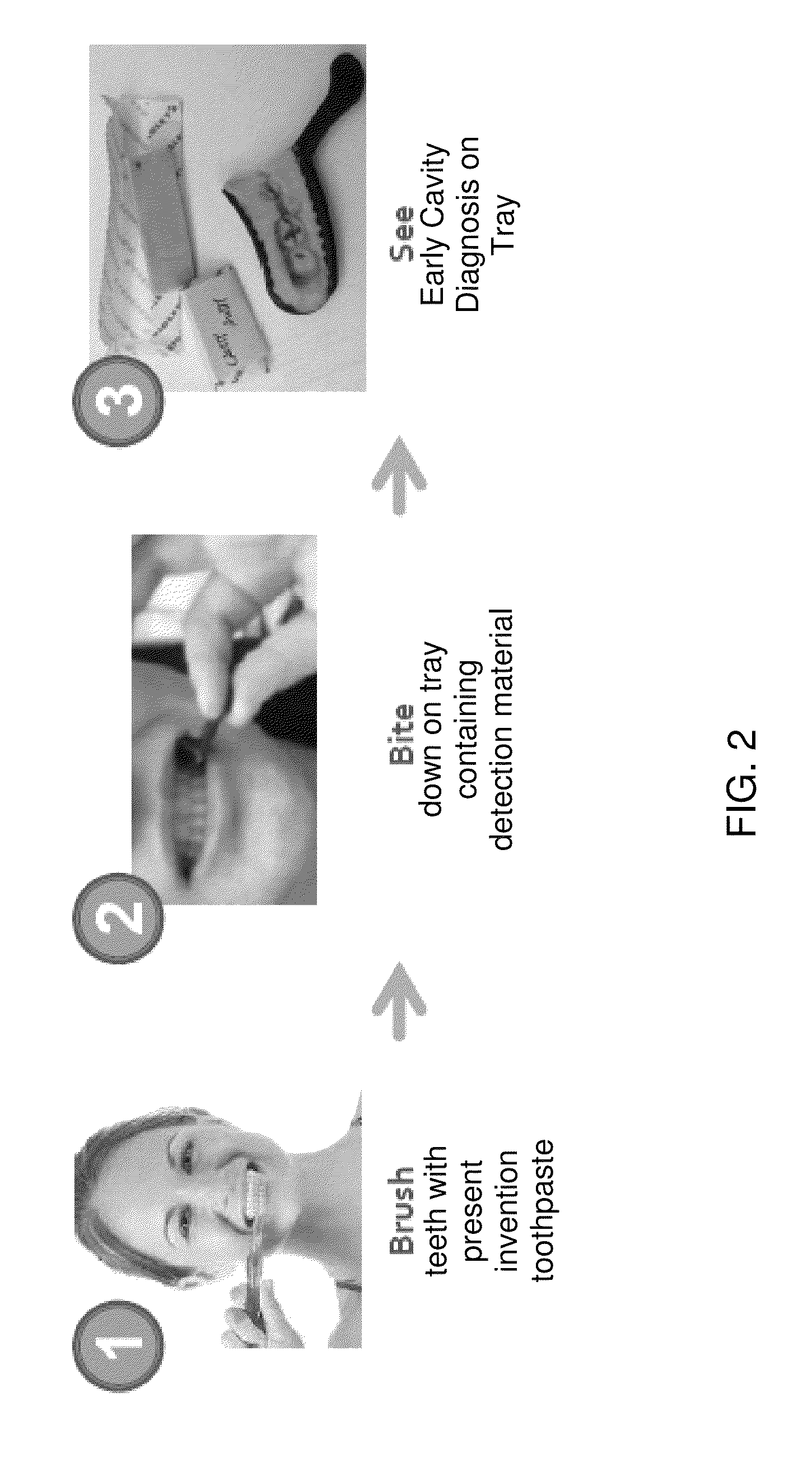 Methodology of dental caries detection