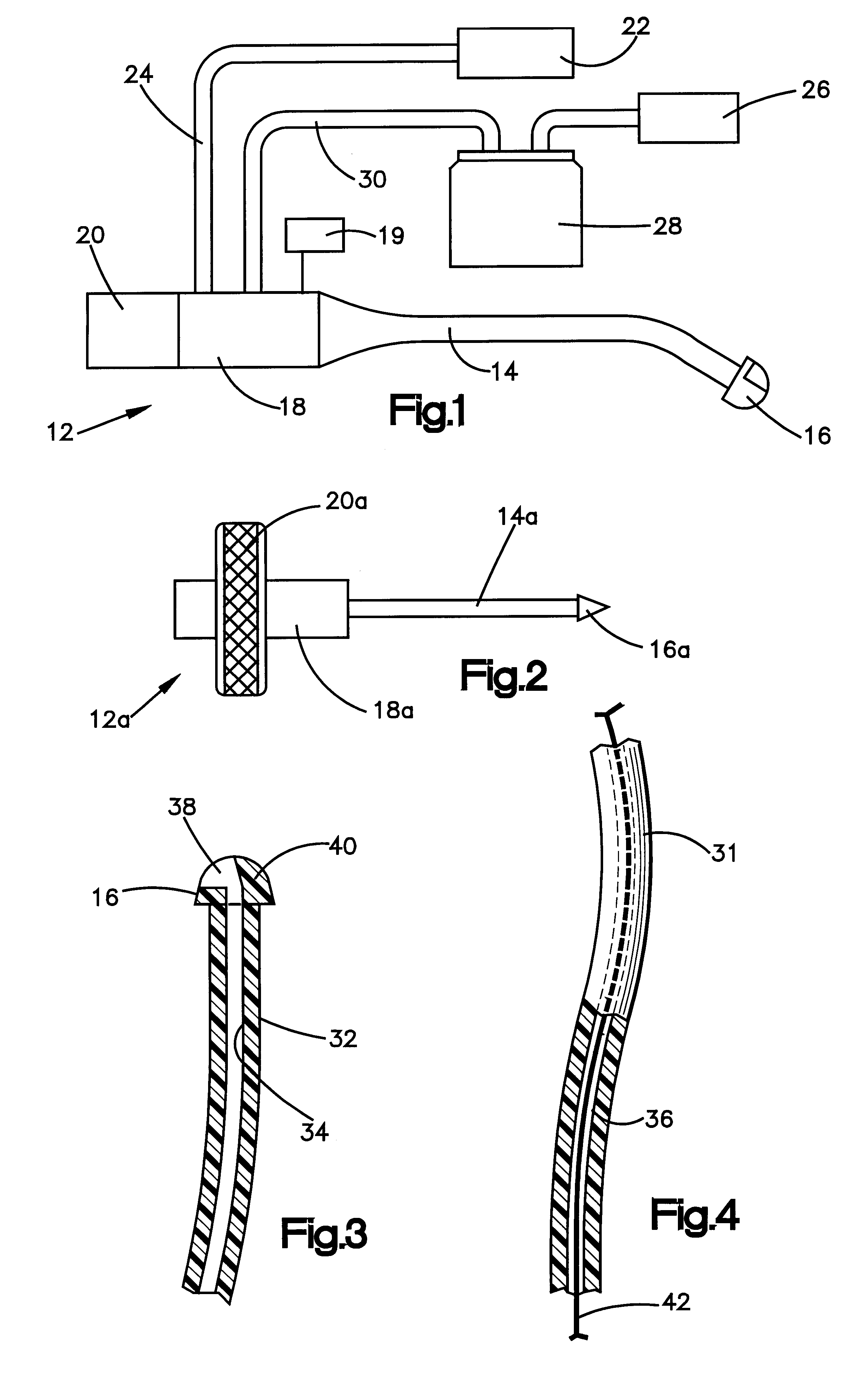 Apparatus and method for tissue removal