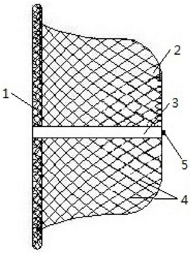 patent ductus arteriosus occluder