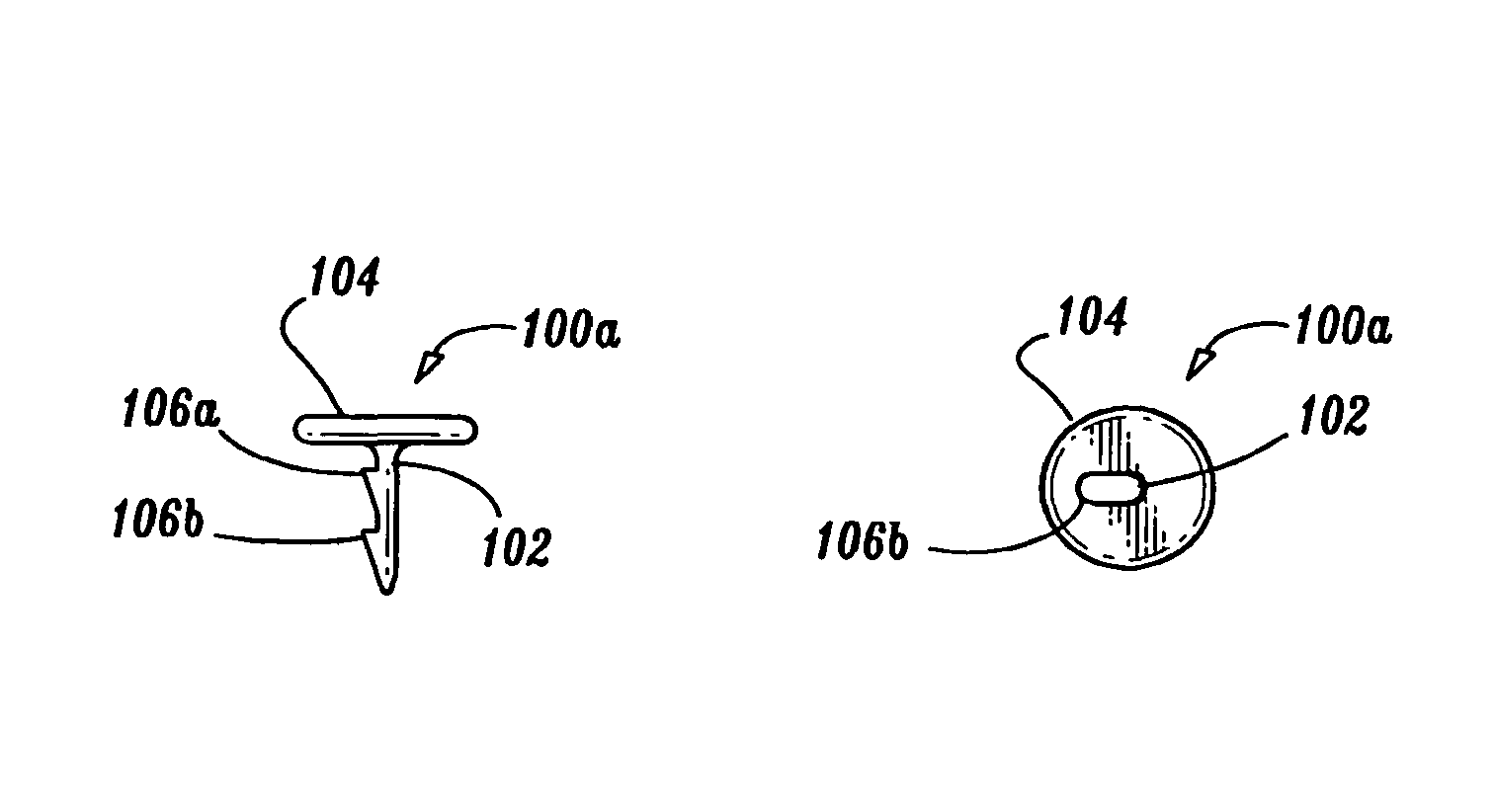 Surgical fasteners