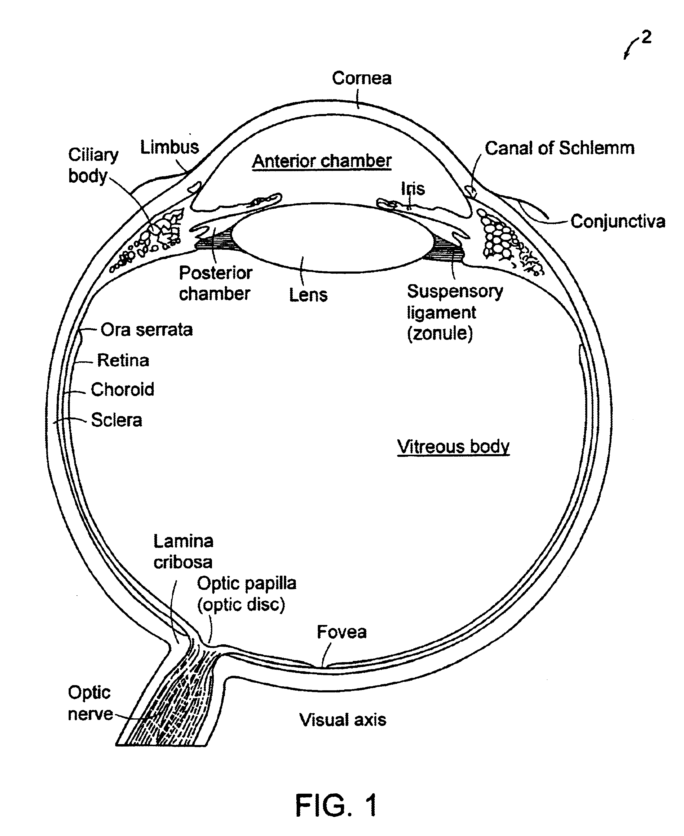 Laminar cribosa puncture device, methods related to use of such a device and methods for treating central retinal vein occulsions