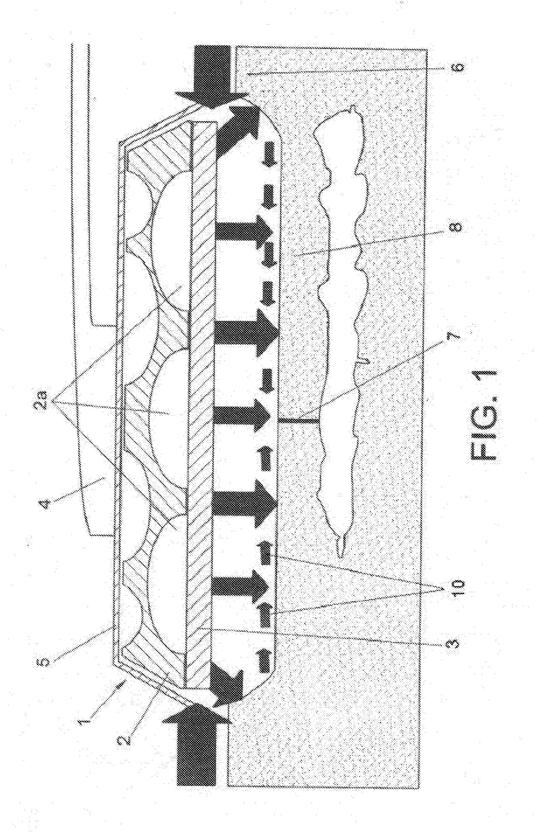 Vacuum dressing applicable as post-operative compression treatment