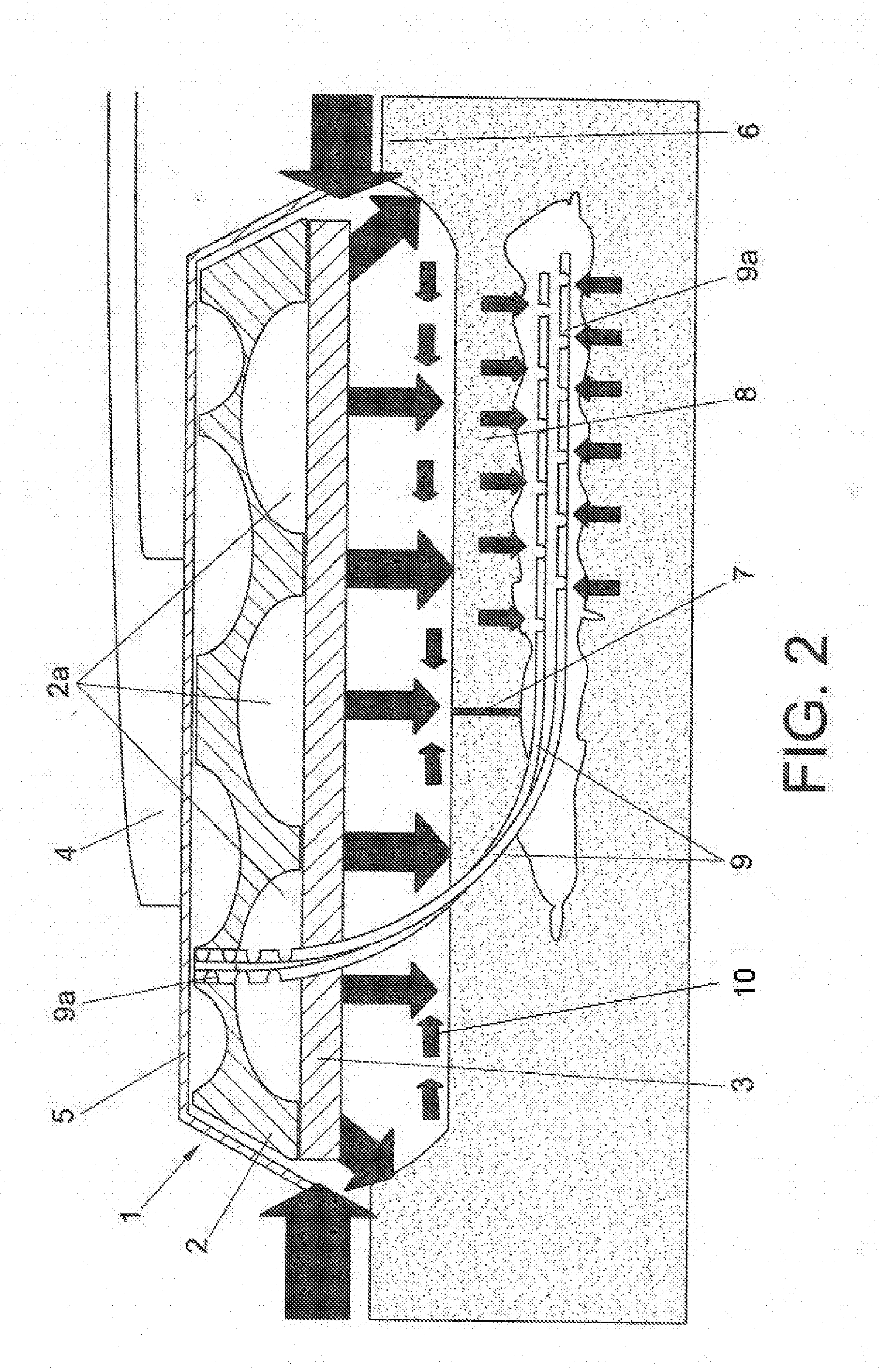 Vacuum dressing applicable as post-operative compression treatment