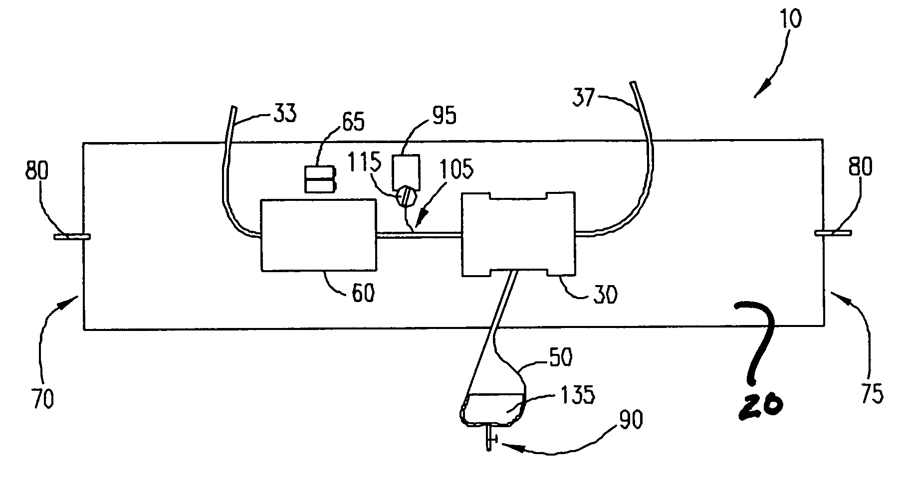 Wearable ultrafiltration device