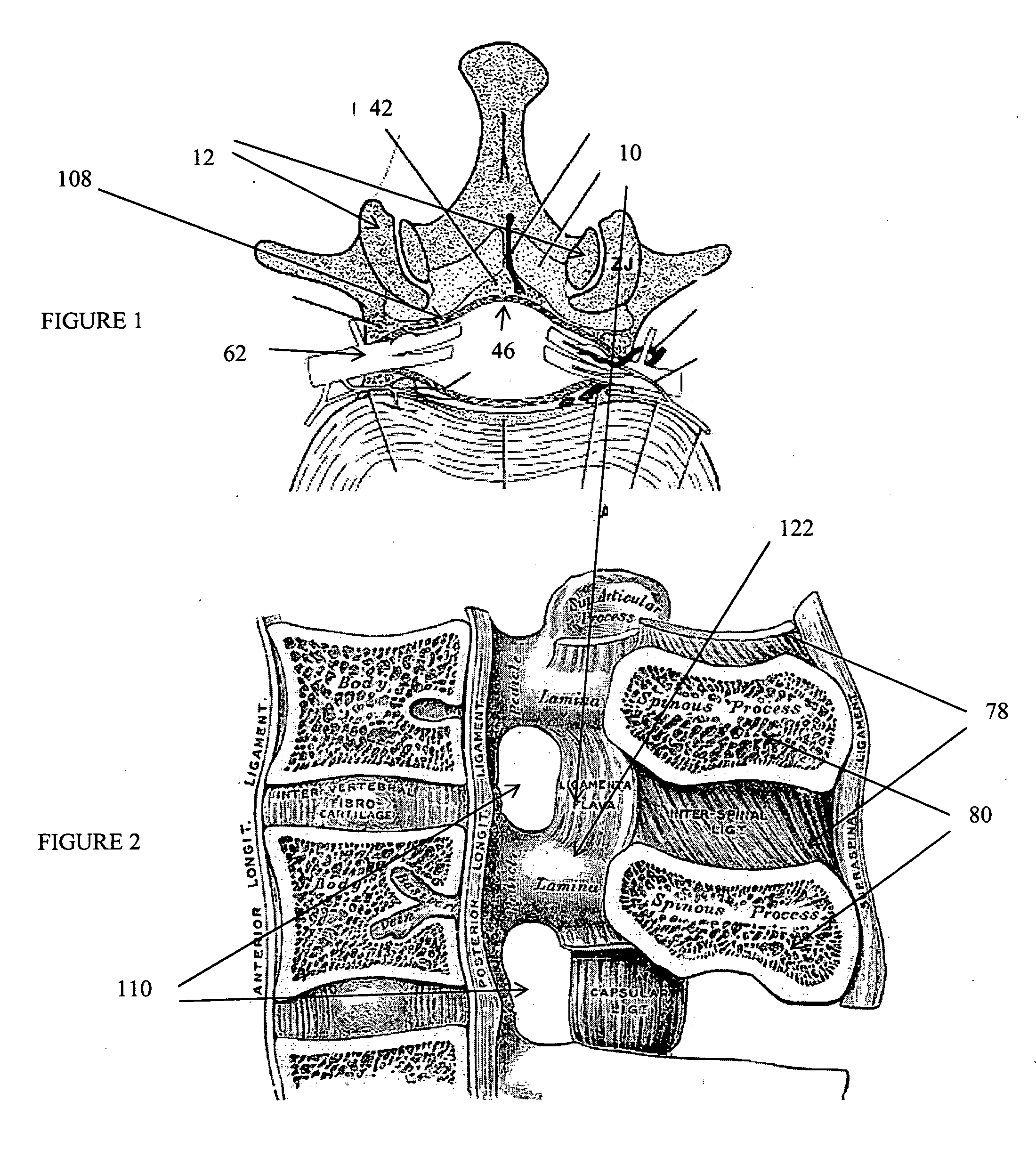 Devices and methods for tissue access