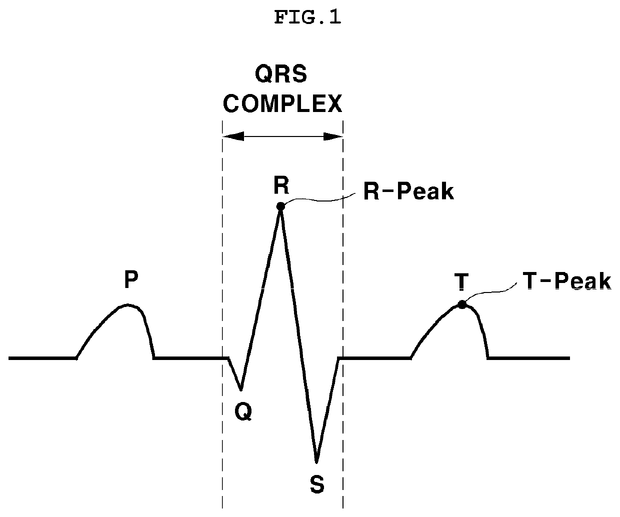 R wave detection method using periodicity of electrocardiogram signal