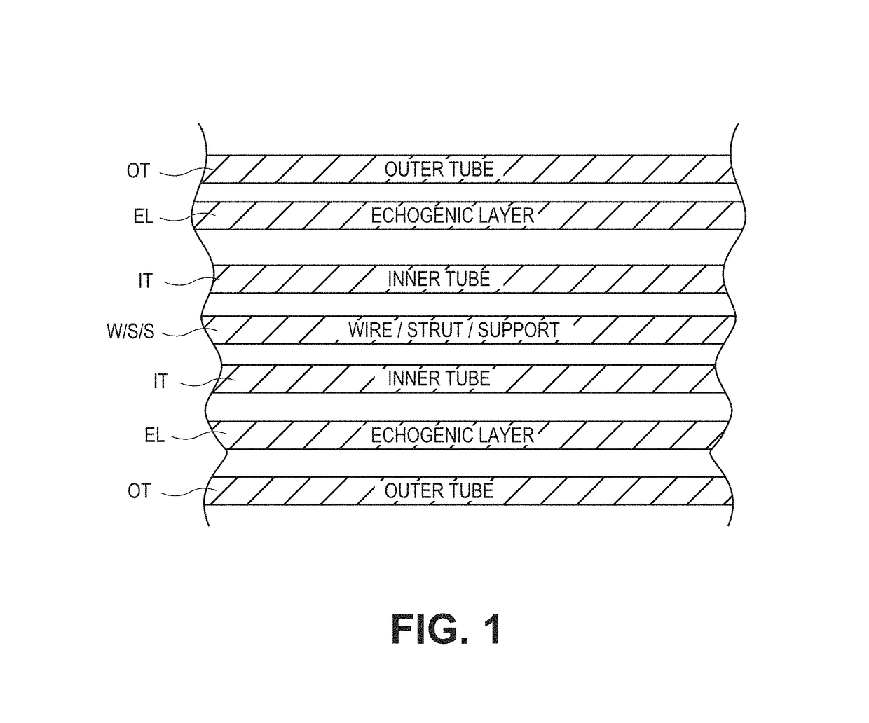 Filters with echogenic characteristics