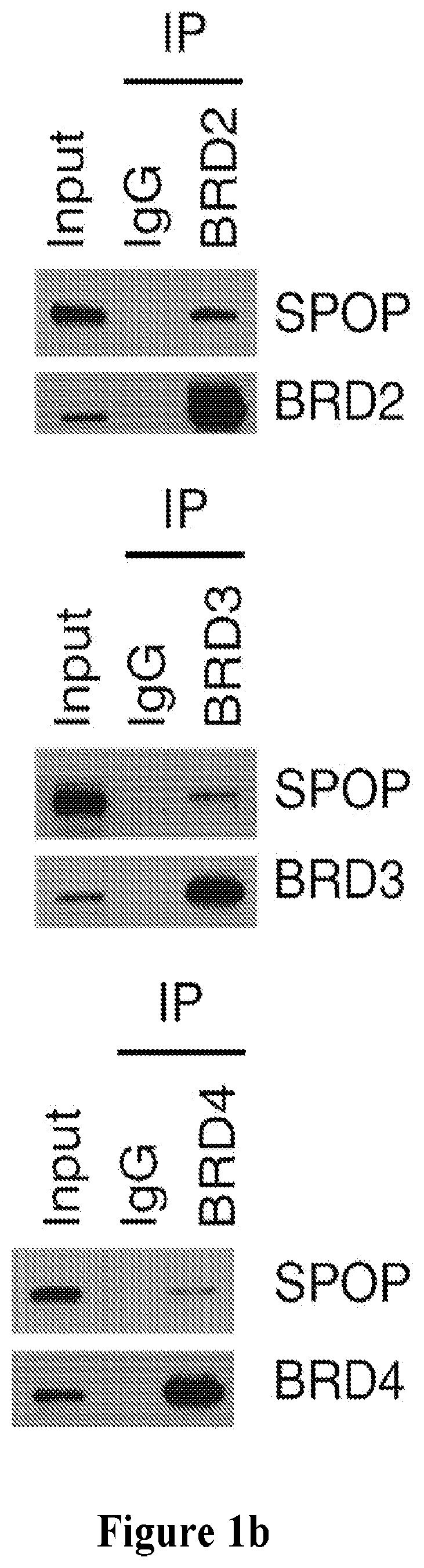 Methods and materials for identifying and treating bet inhibitor-resistant cancers