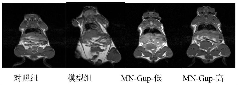 Bifidobacterium lactis MN-Gup fermented milk for relieving obesity and preparation method thereof