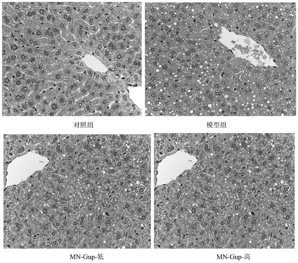 Bifidobacterium lactis MN-Gup fermented milk for relieving obesity and preparation method thereof