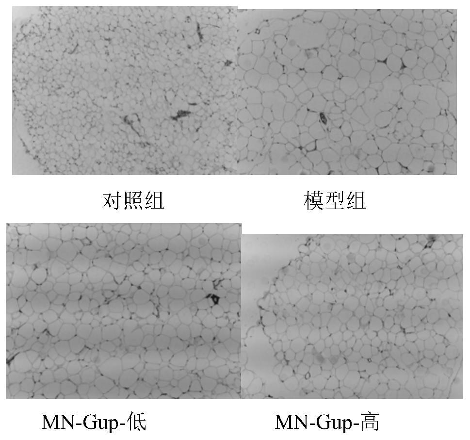 Bifidobacterium lactis MN-Gup fermented milk for relieving obesity and preparation method thereof