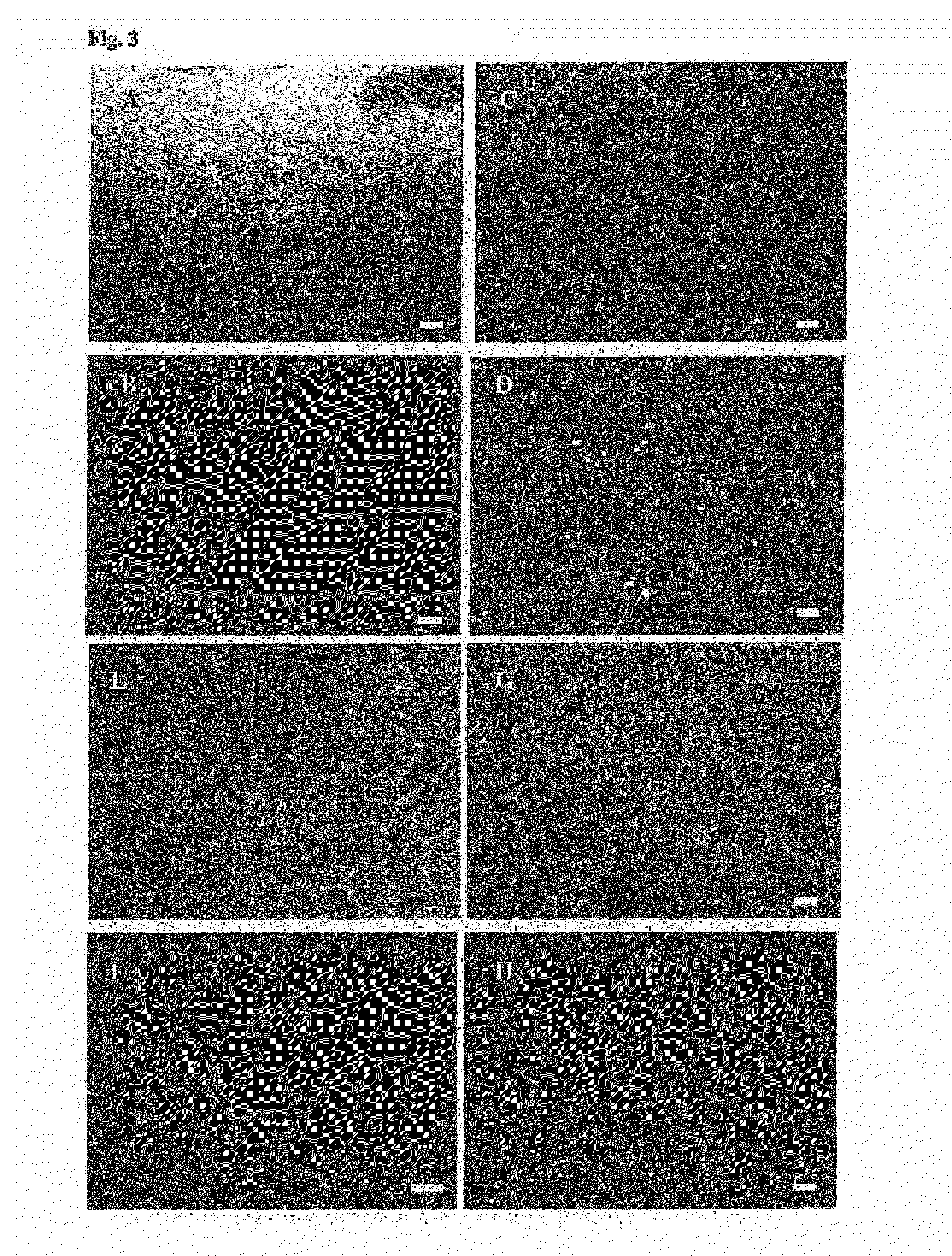 Antibiotic peptides