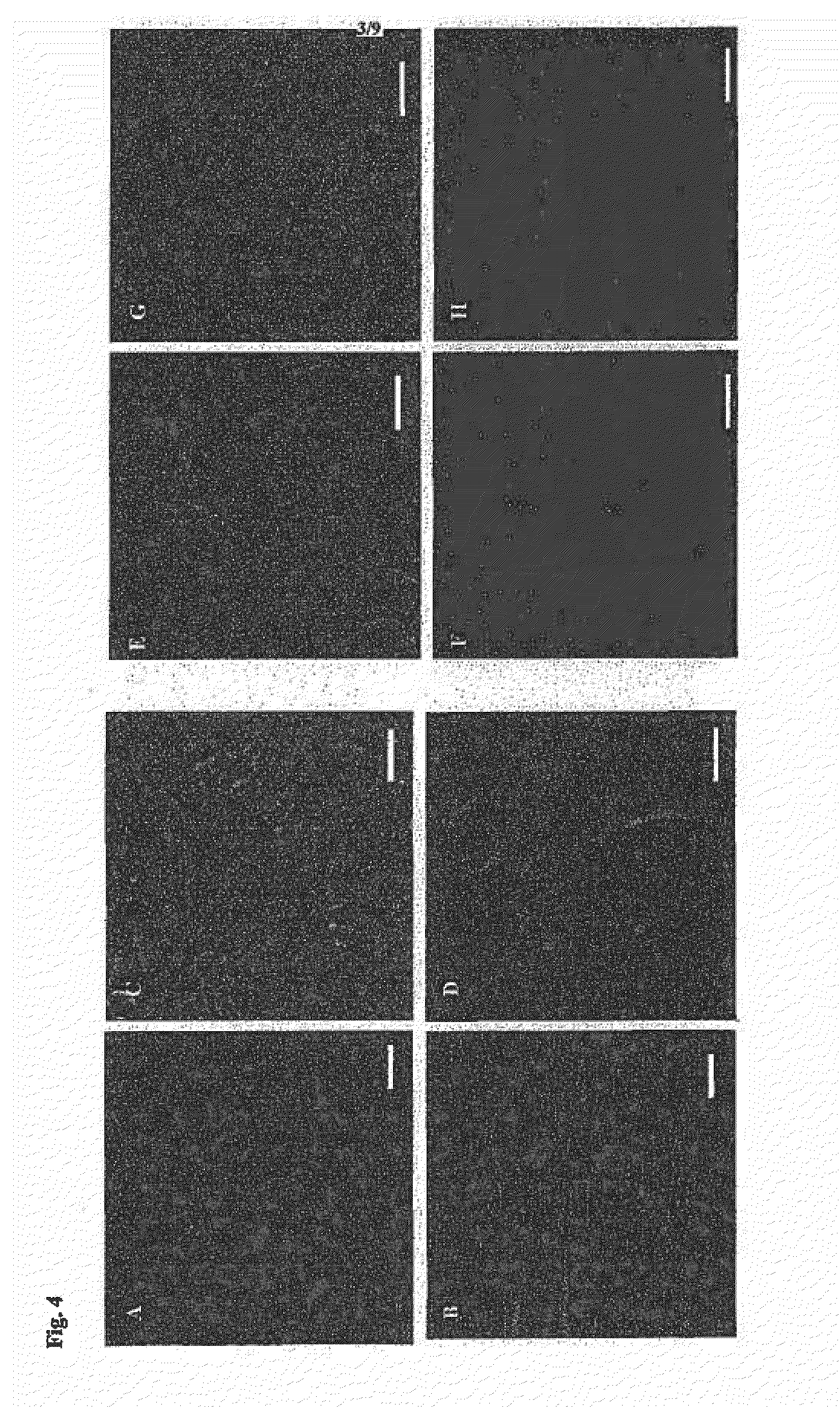 Antibiotic peptides