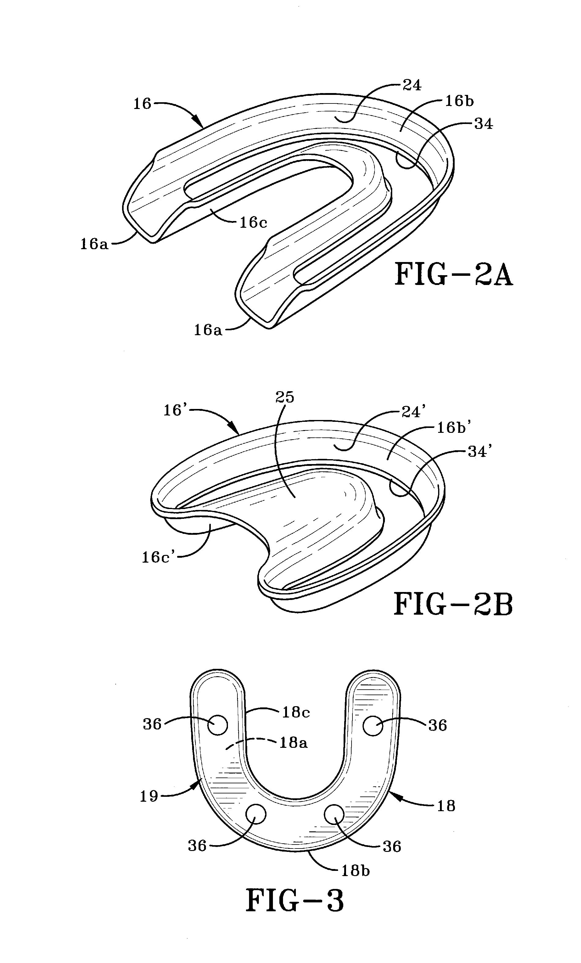 Method of installing a final dental prosthesis