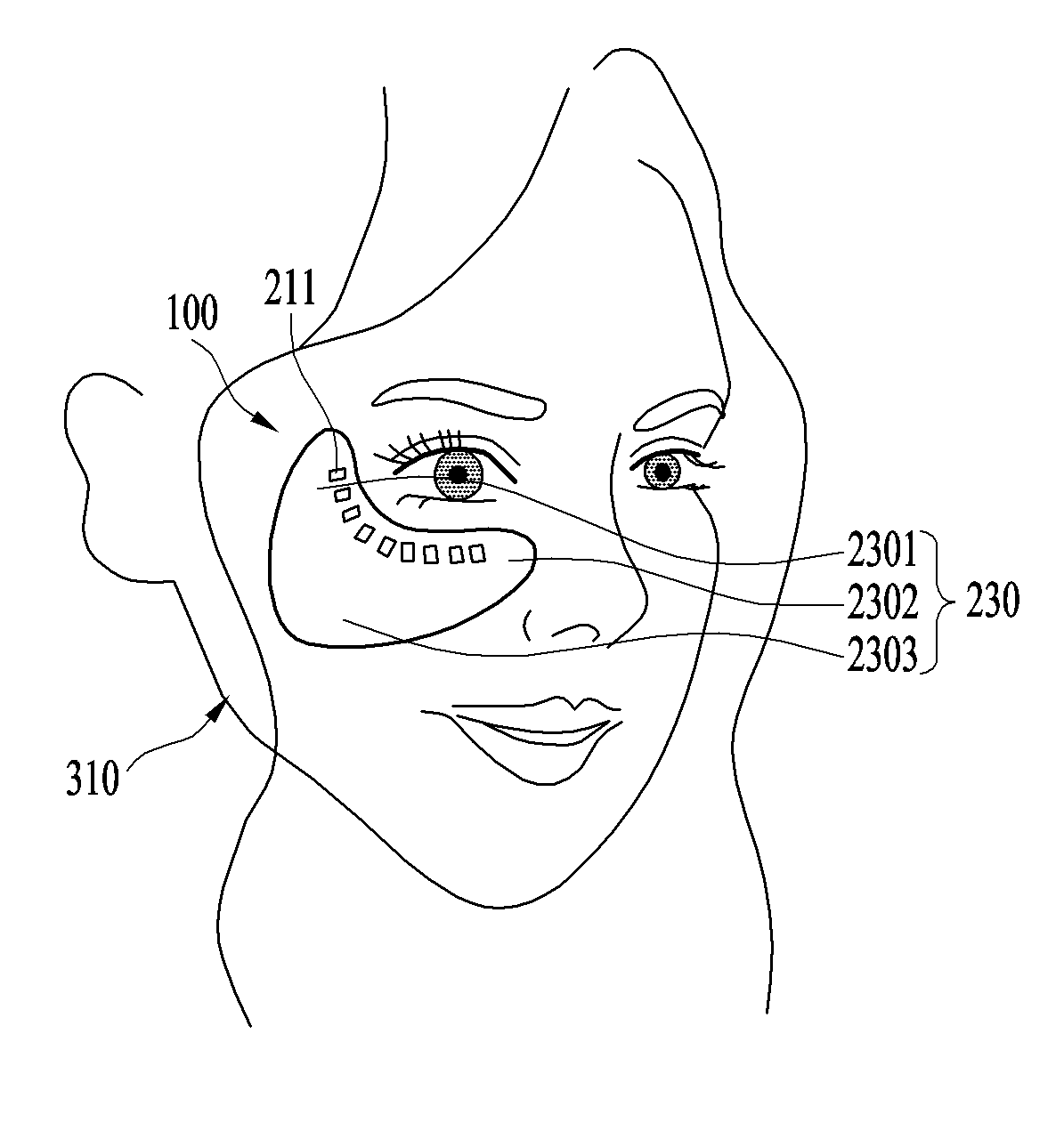 Skin care device