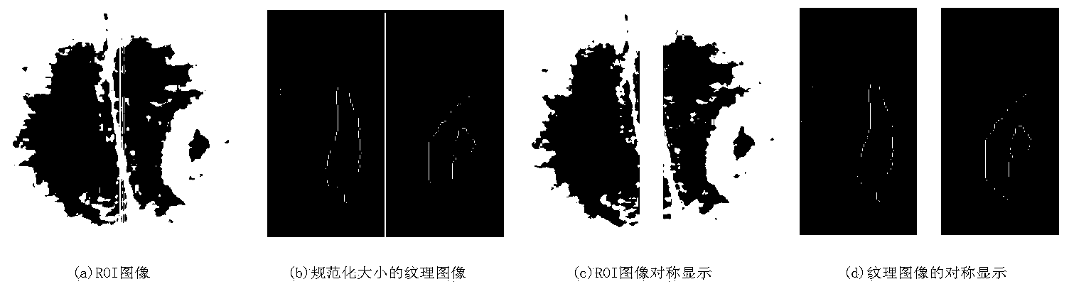 Medical image multi-stage classification method based on symmetry theory