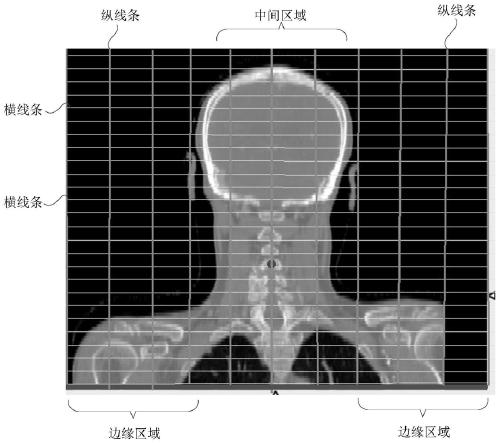 Multi-modal image registration method and device, electronic equipment and storage medium