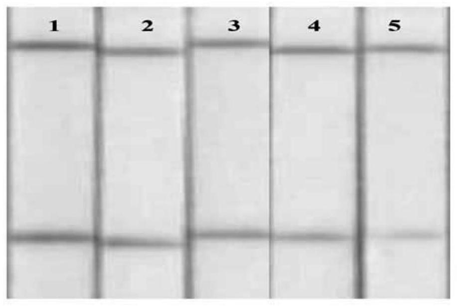 Method for rapidly detecting ricin through colloidal gold lateral flow chromatography and colloidal gold lateral flow chromatography kit