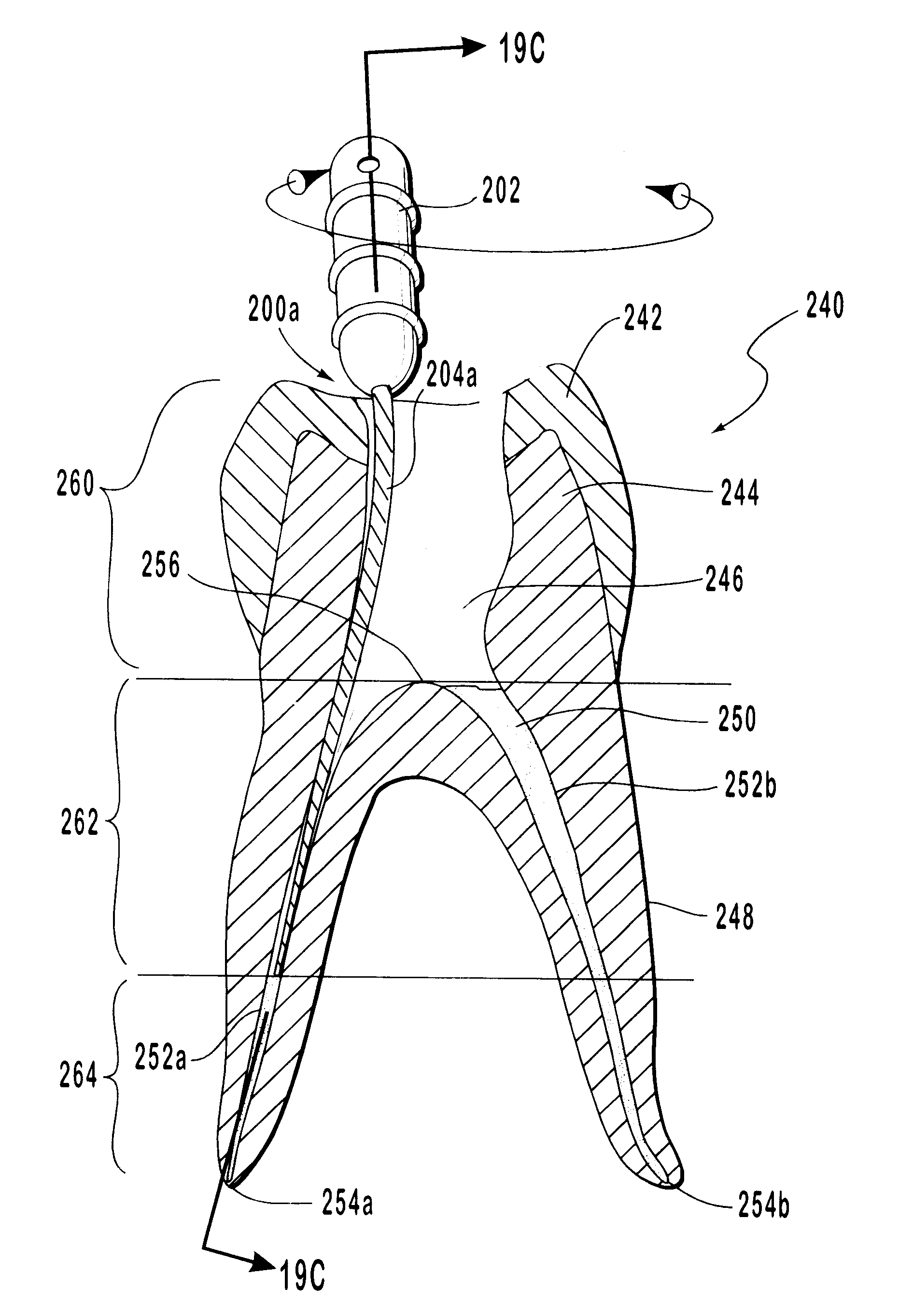 Endodontic systems and methods for the anatomical, sectional and progressive corono-apical preparation of root canals with dedicated stainless steel instruments and dedicated nickel/titanium instruments