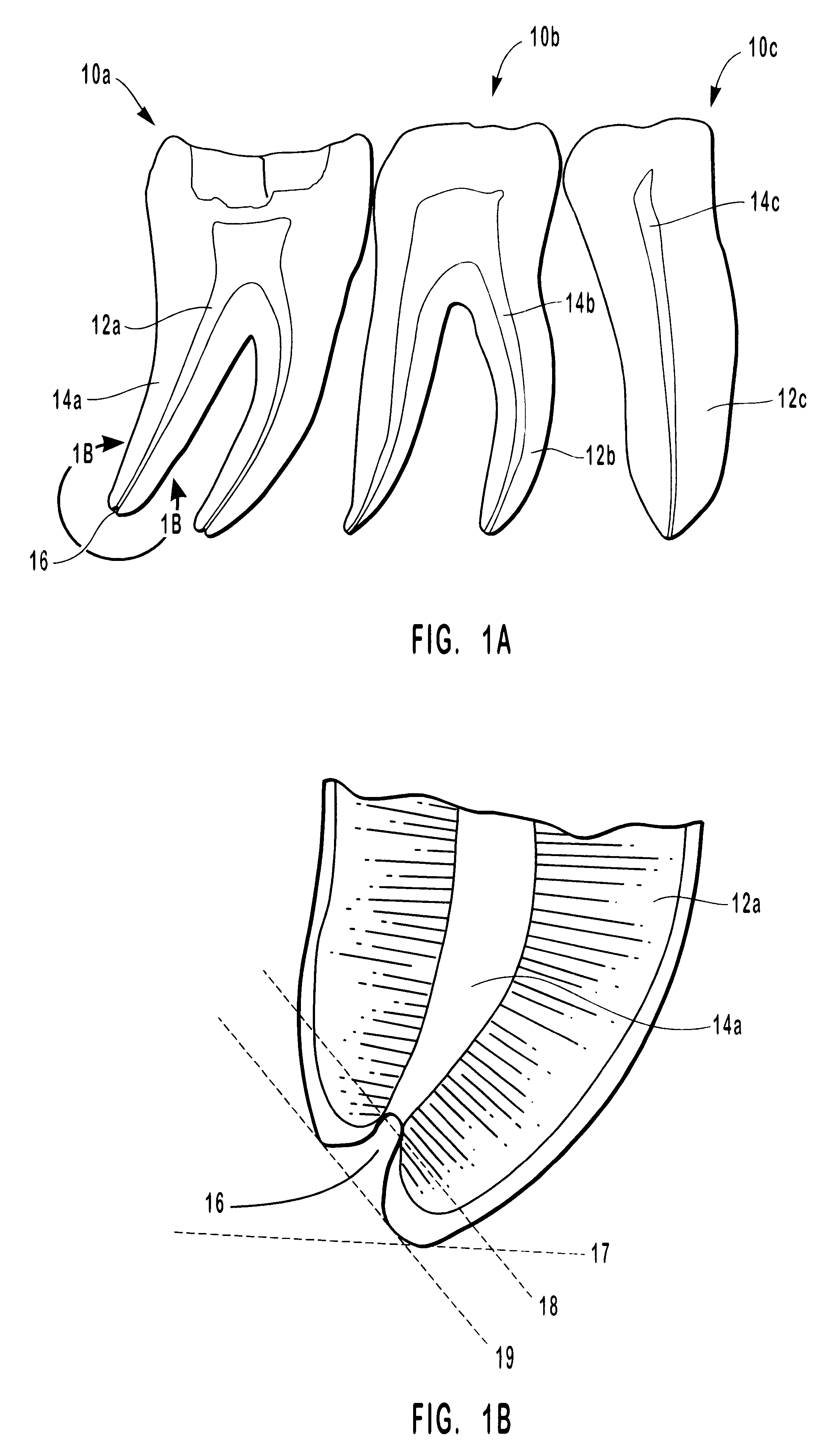 Endodontic systems and methods for the anatomical, sectional and progressive corono-apical preparation of root canals with dedicated stainless steel instruments and dedicated nickel/titanium instruments