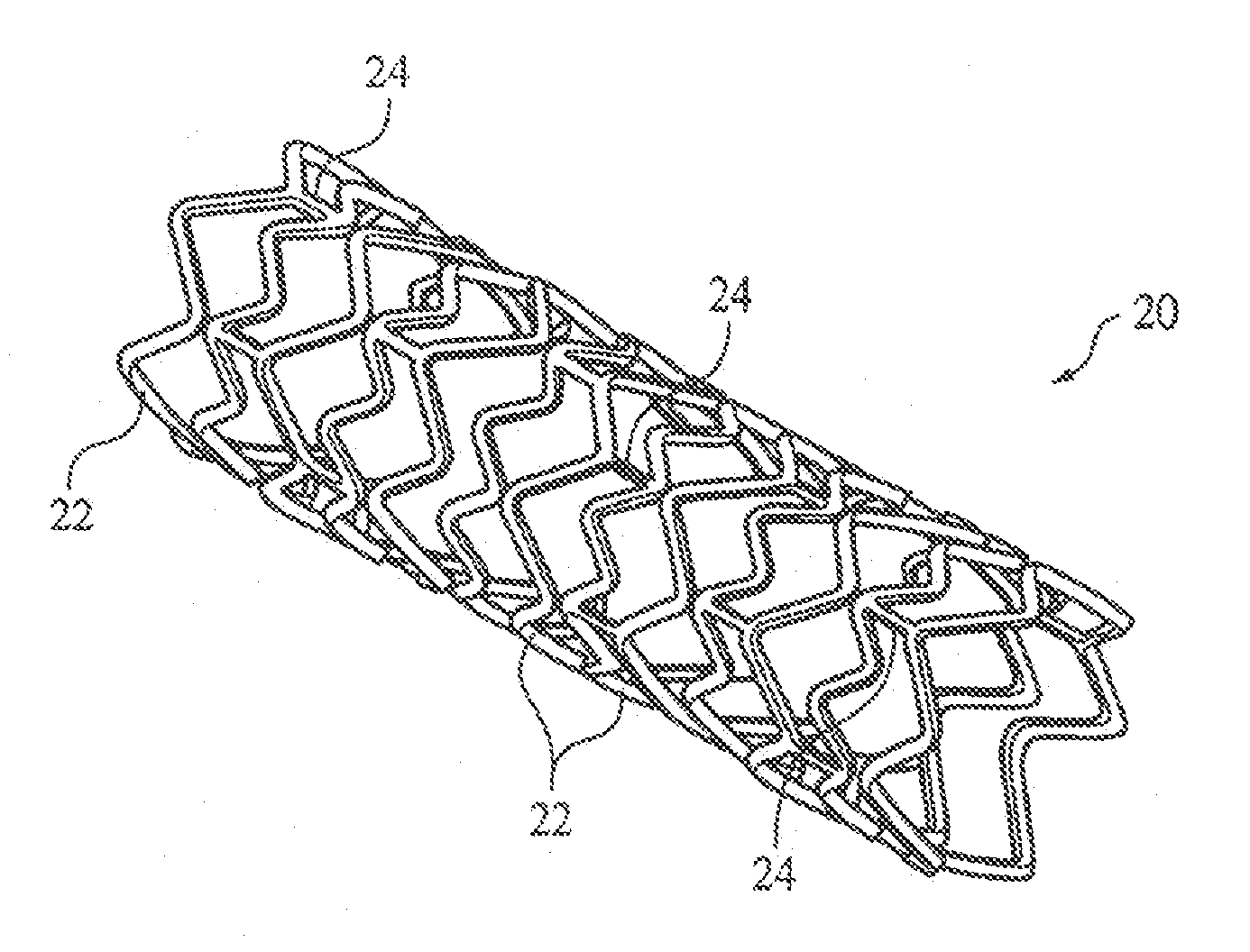 Bioerodible Magnesium Alloy Microstructures for Endoprostheses