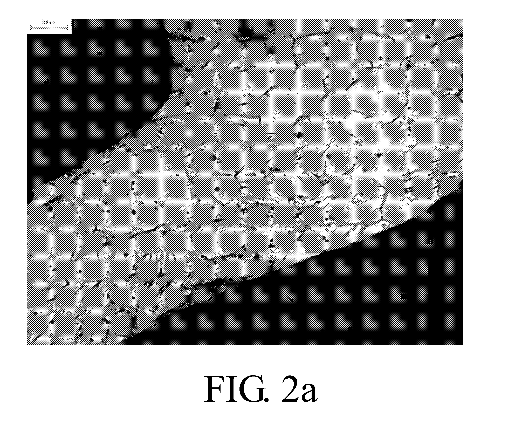 Bioerodible Magnesium Alloy Microstructures for Endoprostheses