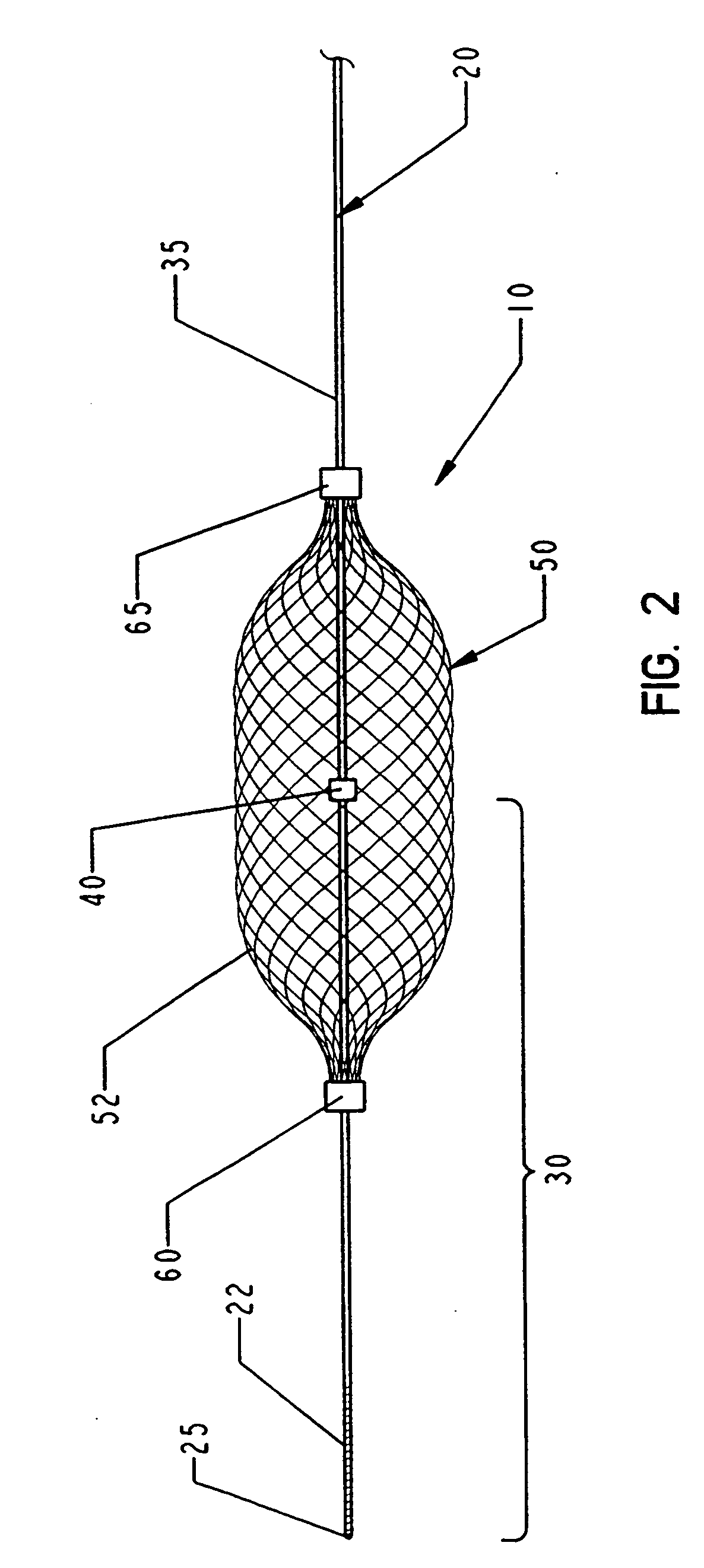 Slideable vascular filter