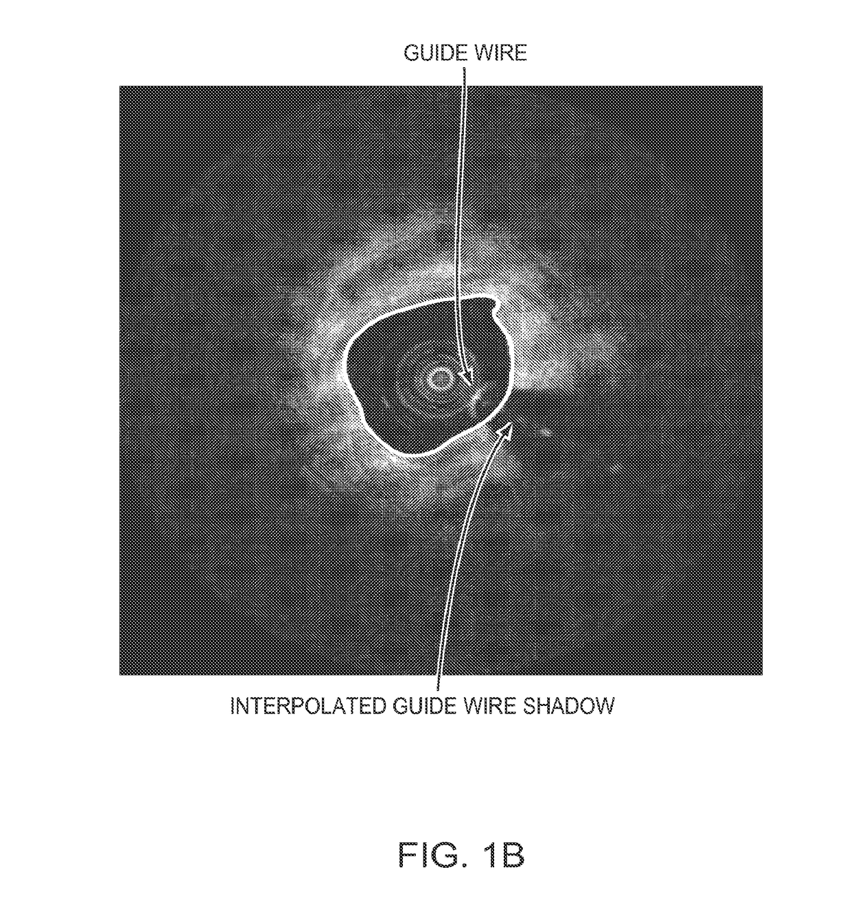 Lumen Morphology and Vascular Resistance Measurements Data Collection Systems, Apparatus and Methods