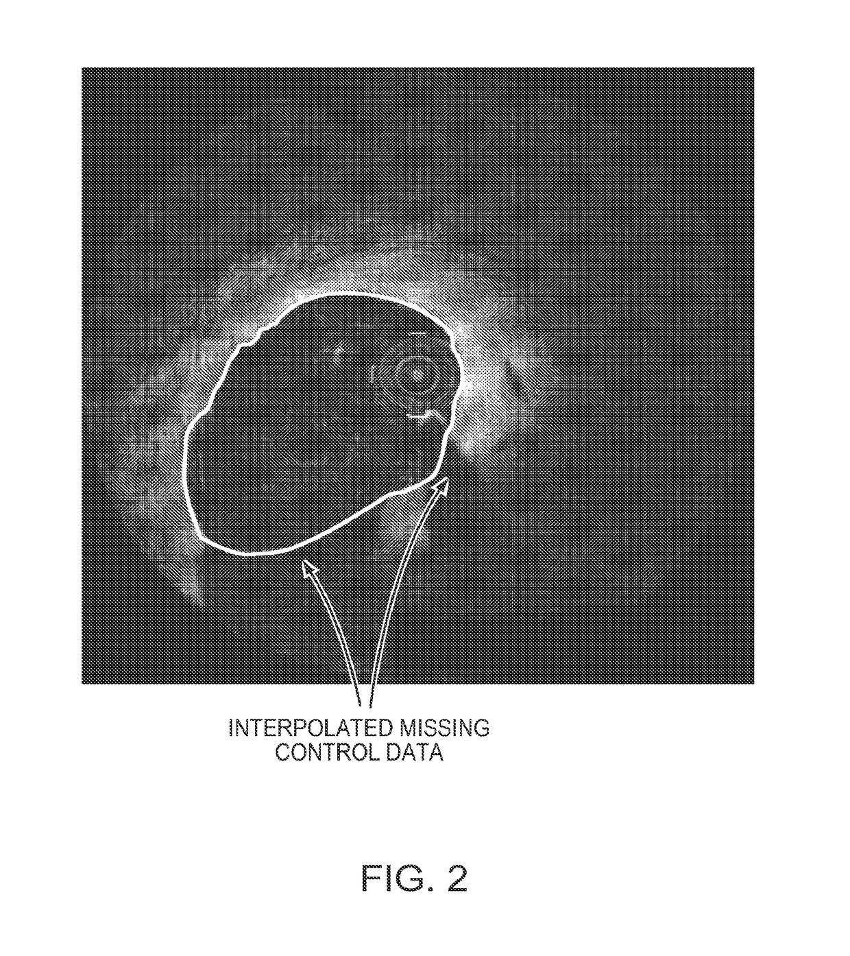 Lumen Morphology and Vascular Resistance Measurements Data Collection Systems, Apparatus and Methods