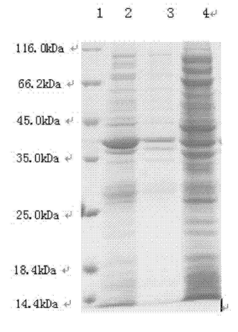 HIV (Human Immunodeficiency Virus) recombinant fusion antigen as well as expression gene and preparation method thereof