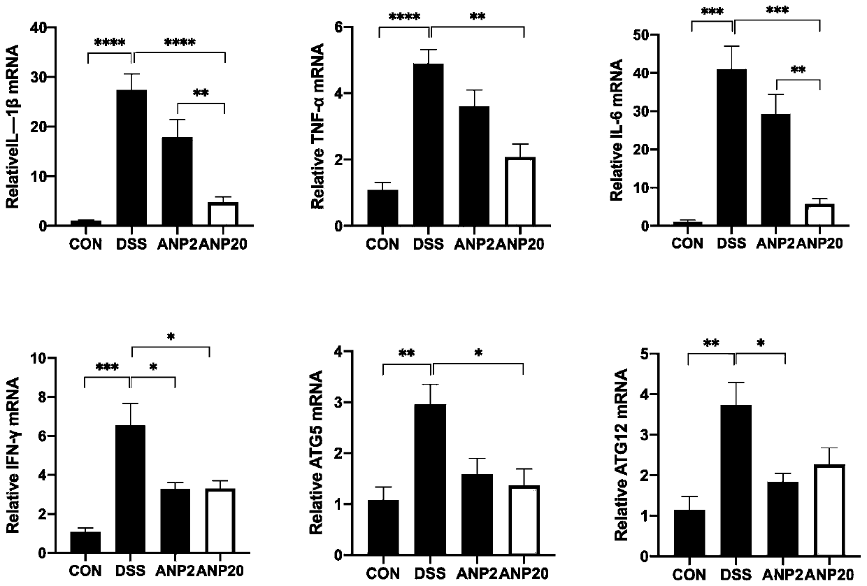 Application of atrial natriuretic peptide in preparation of medicine for treating inflammatory bowel diseases