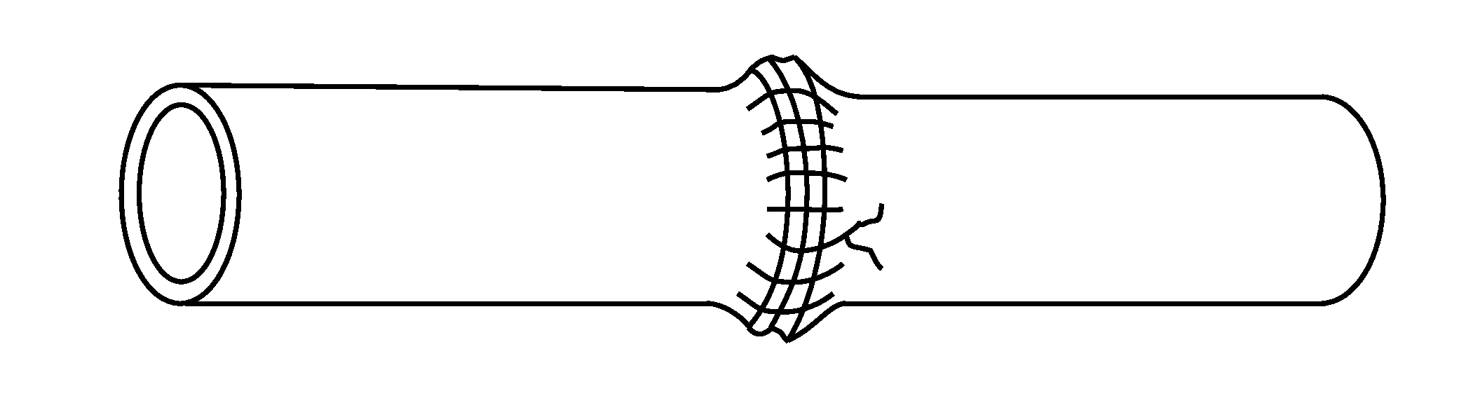 Device for performing end-to-end anastomosis