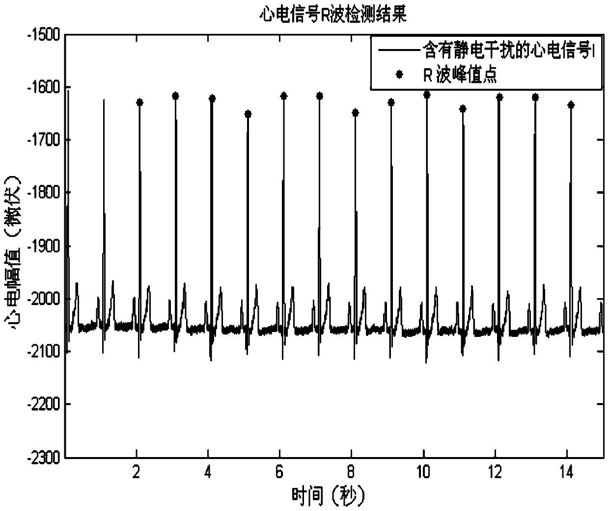 A method and device for removing electrostatic interference in electrocardiographic signals