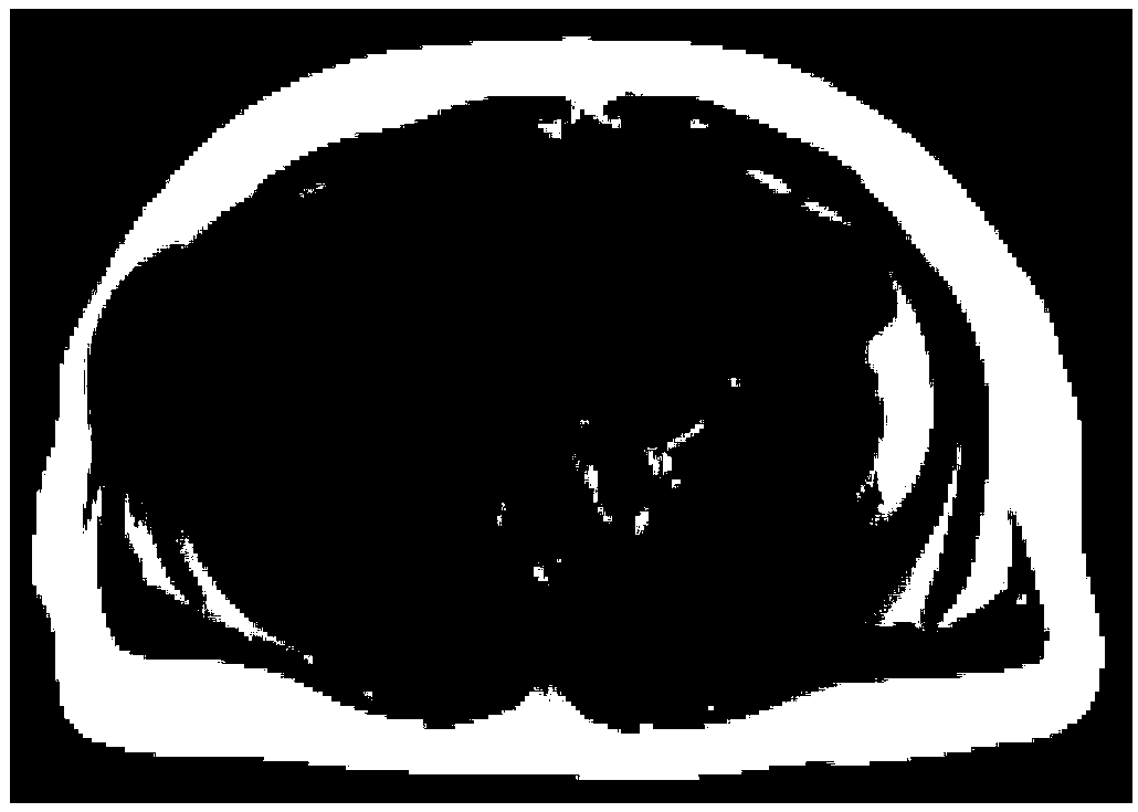 Magnetic resonance spectrum full-automatic post-processing method for quantifying fat content