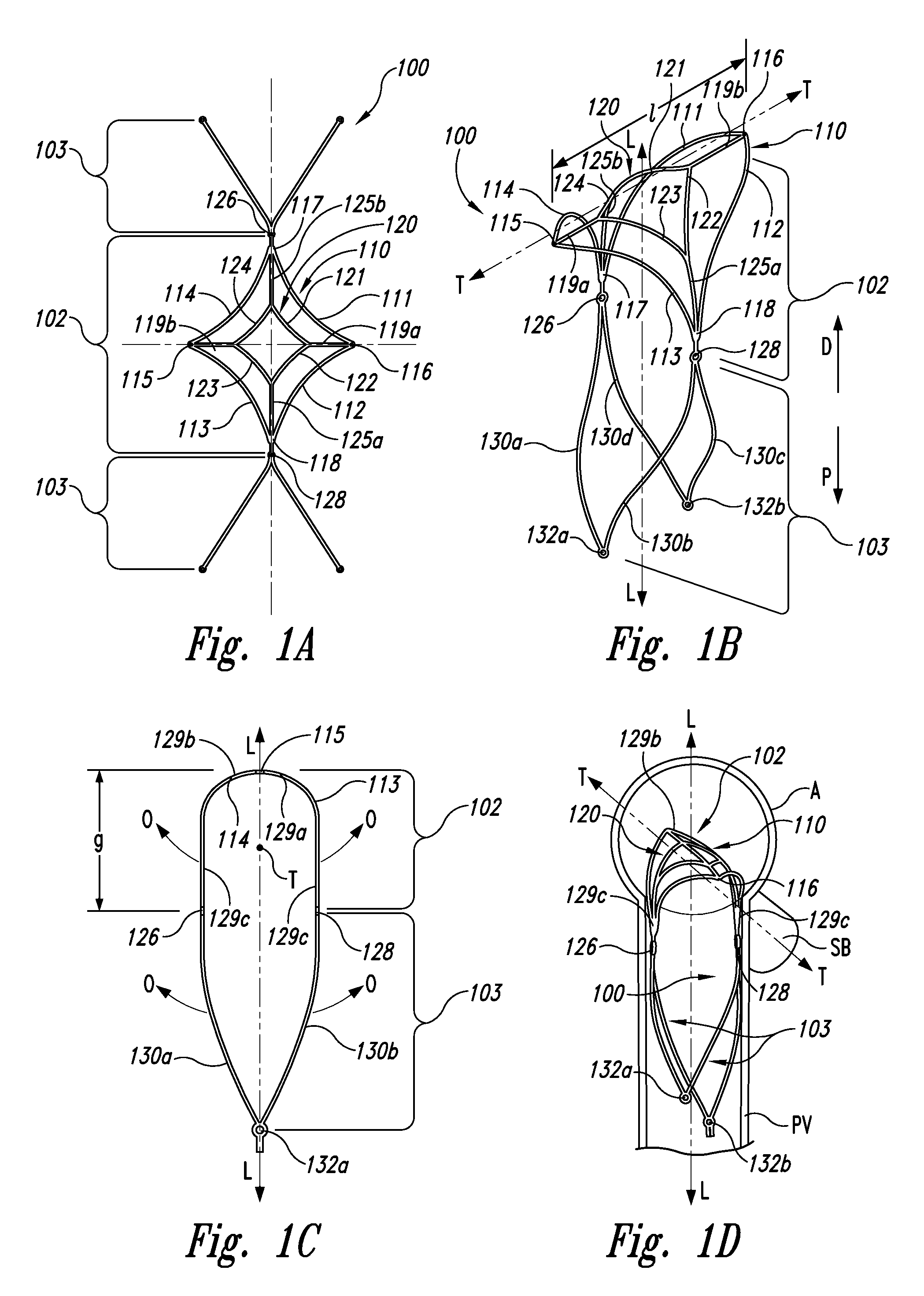 Systems and methods for enclosing an anatomical opening