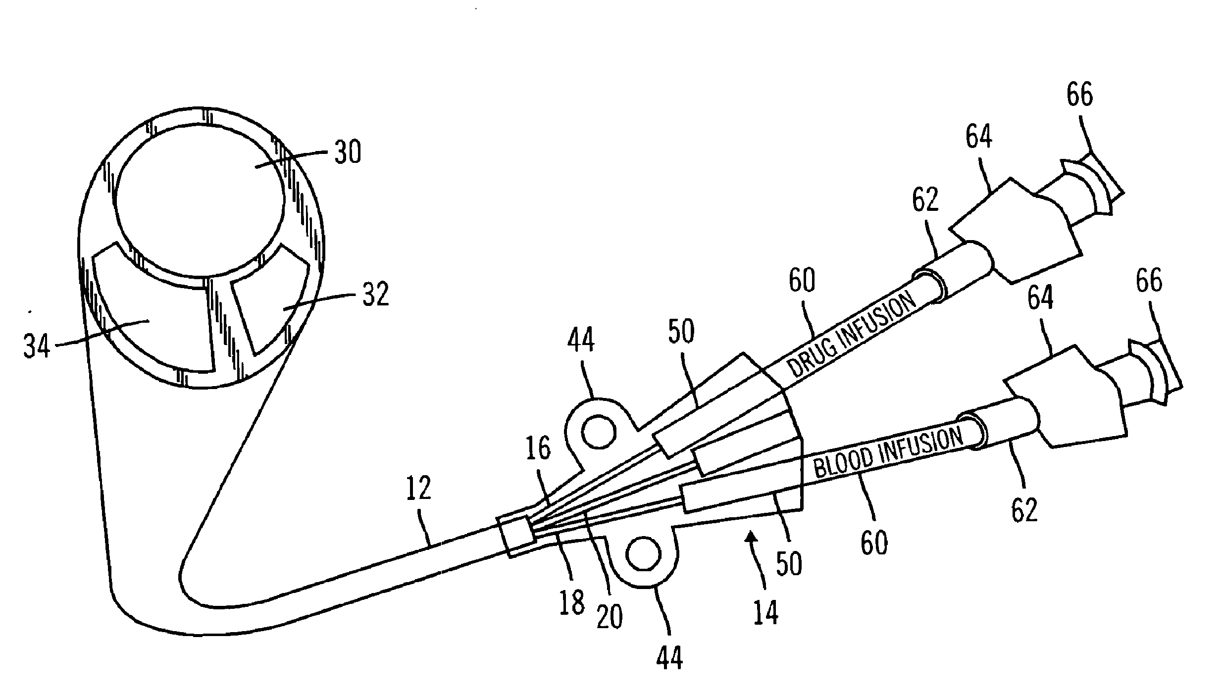 Multilumen catheter